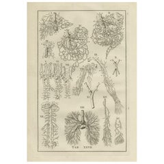 Antique Anatomy Print of the Venous System, 1798