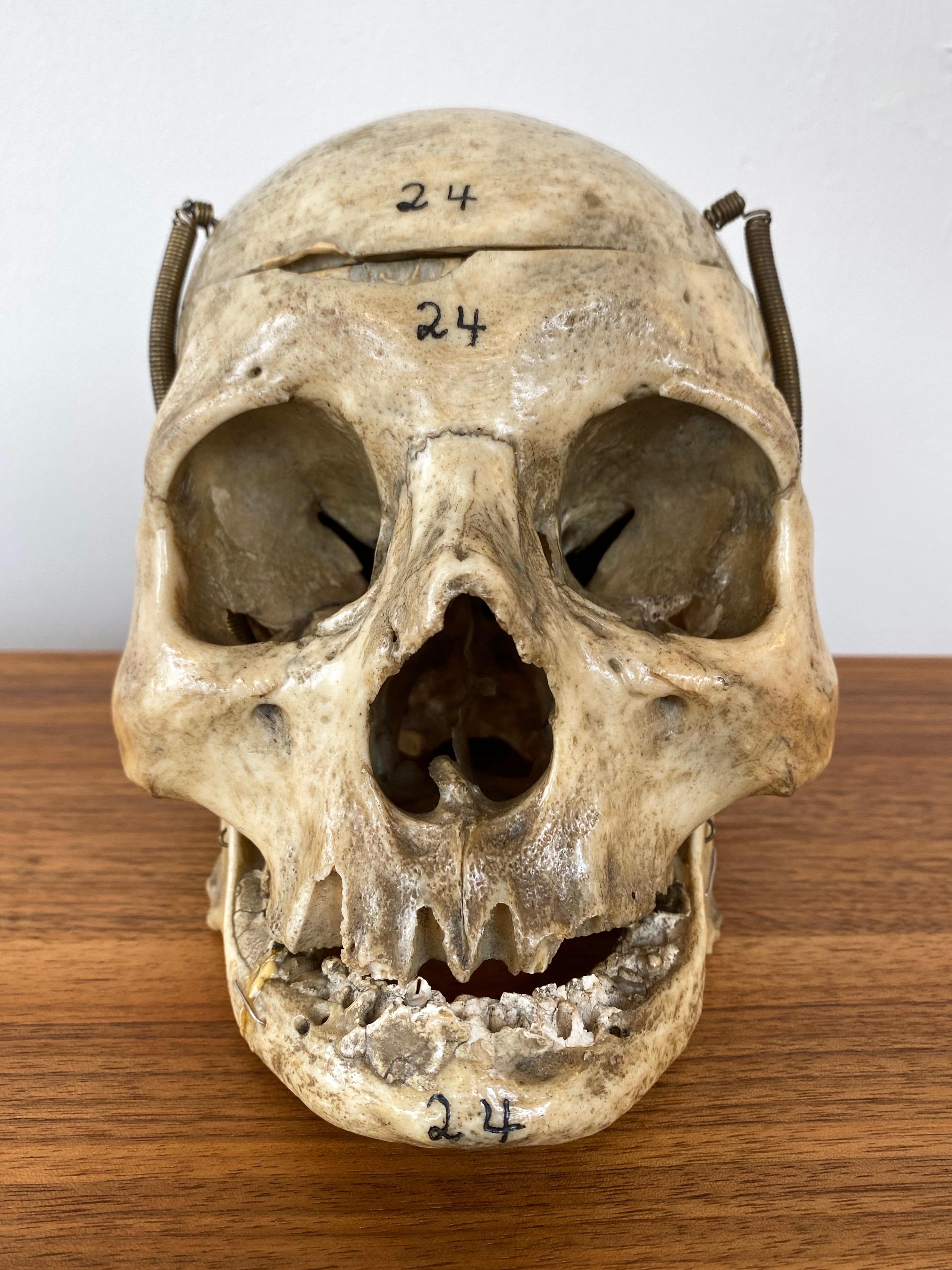 Metal Antique Articulated Human Skull, Medical Teaching Specimen, 1920