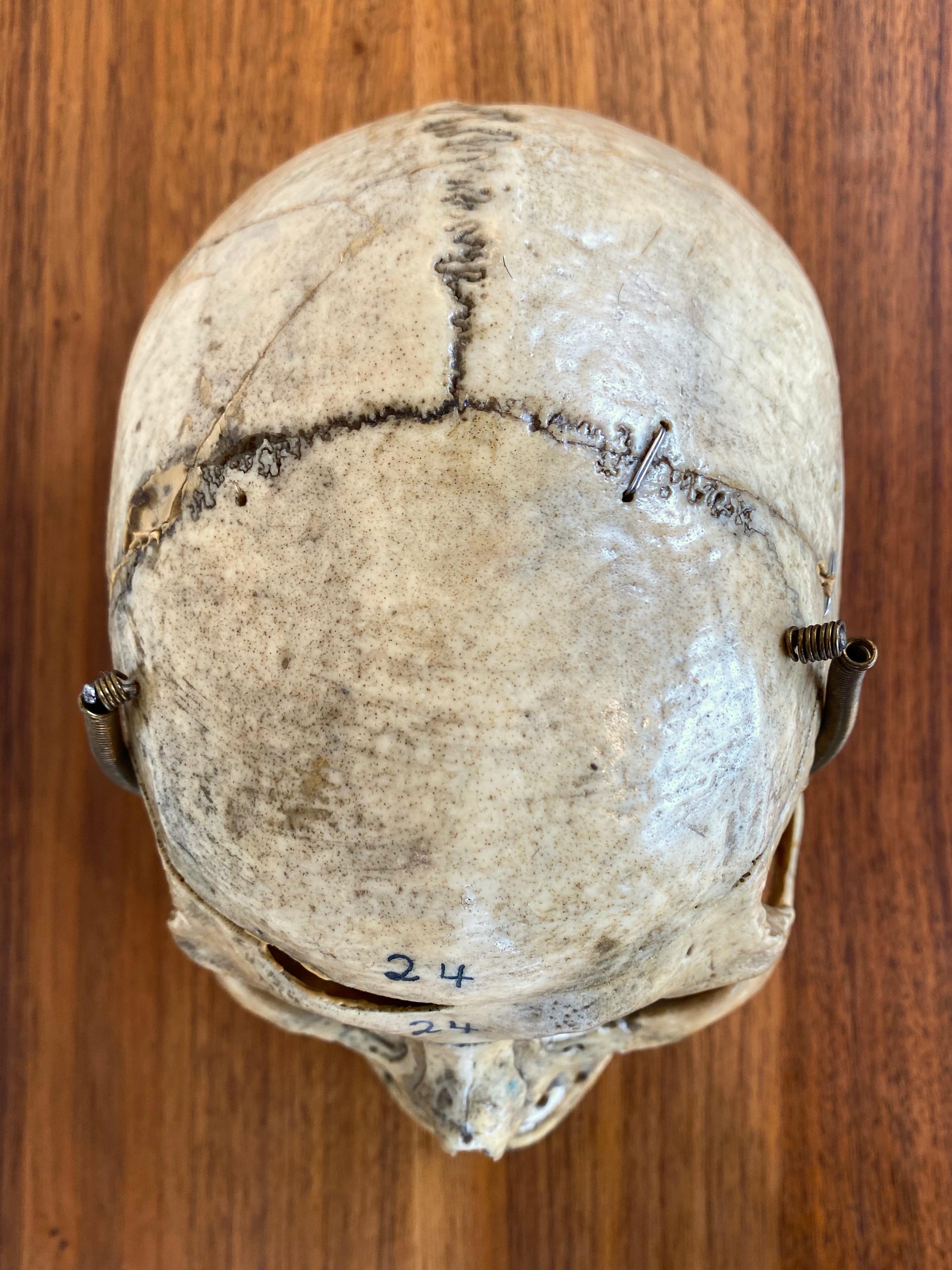 Antique Articulated Human Skull, Medical Teaching Specimen, 1920 1