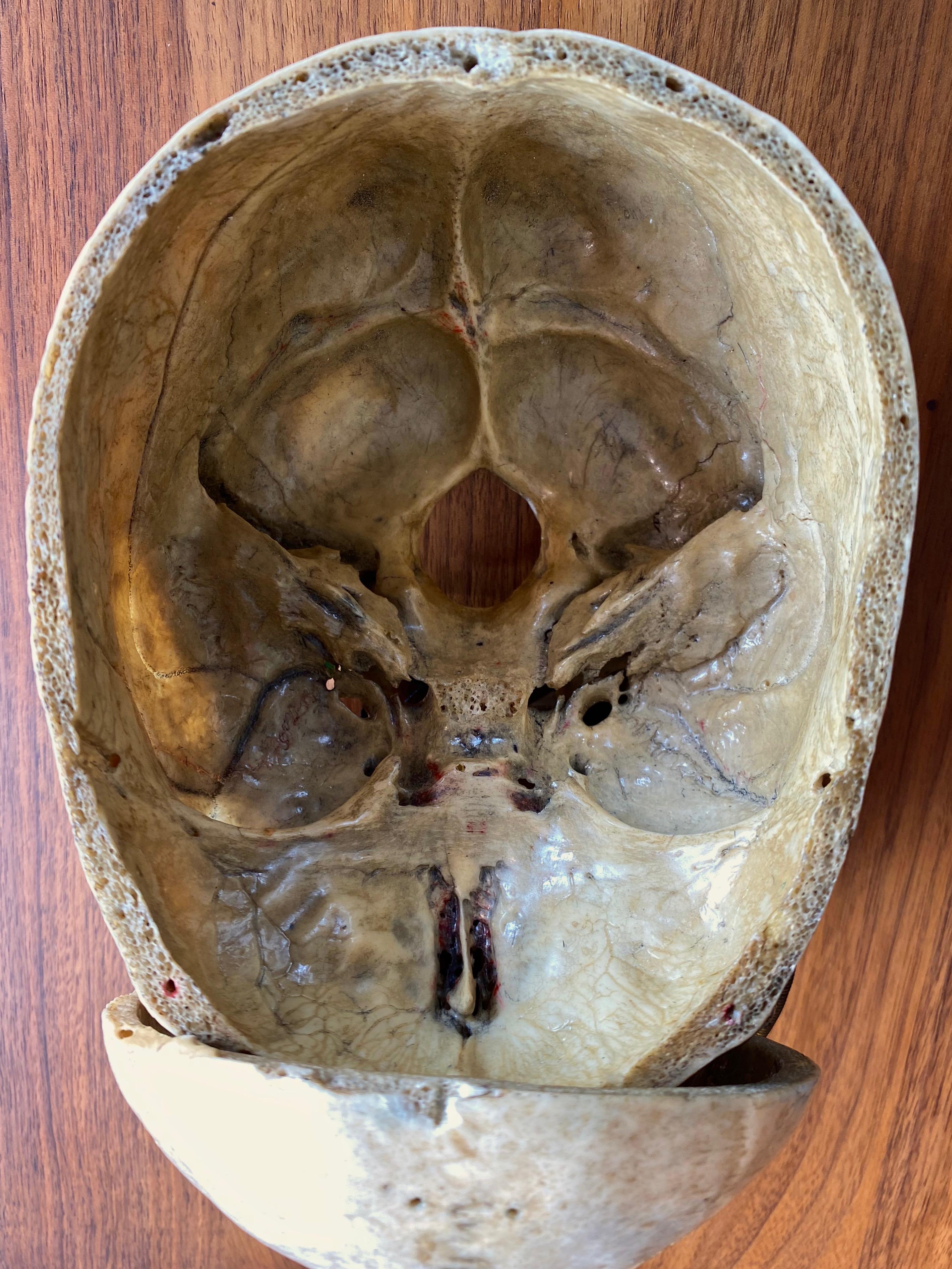 Antique Articulated Human Skull, Medical Teaching Specimen, 1920 2
