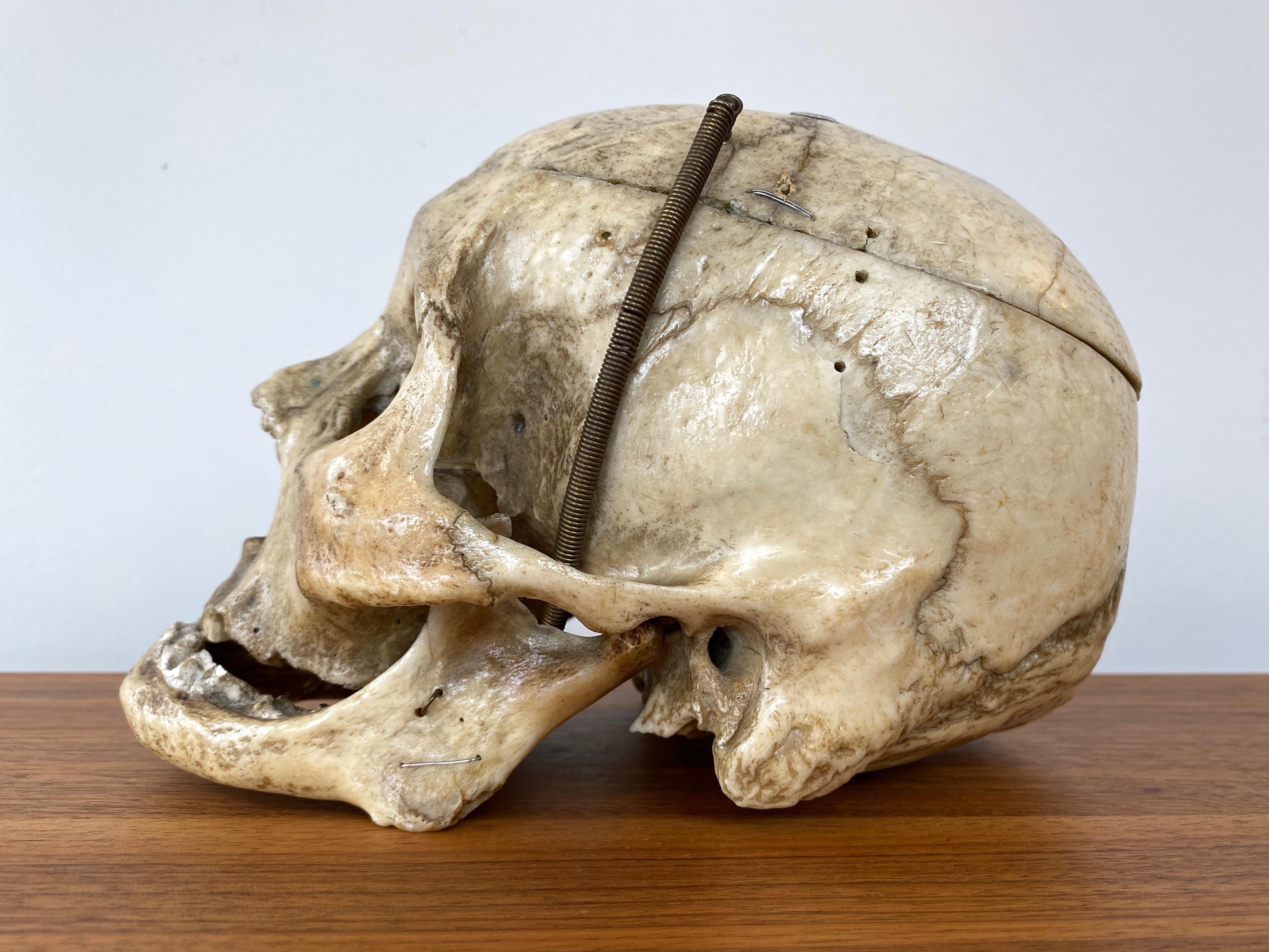 antique human skull
