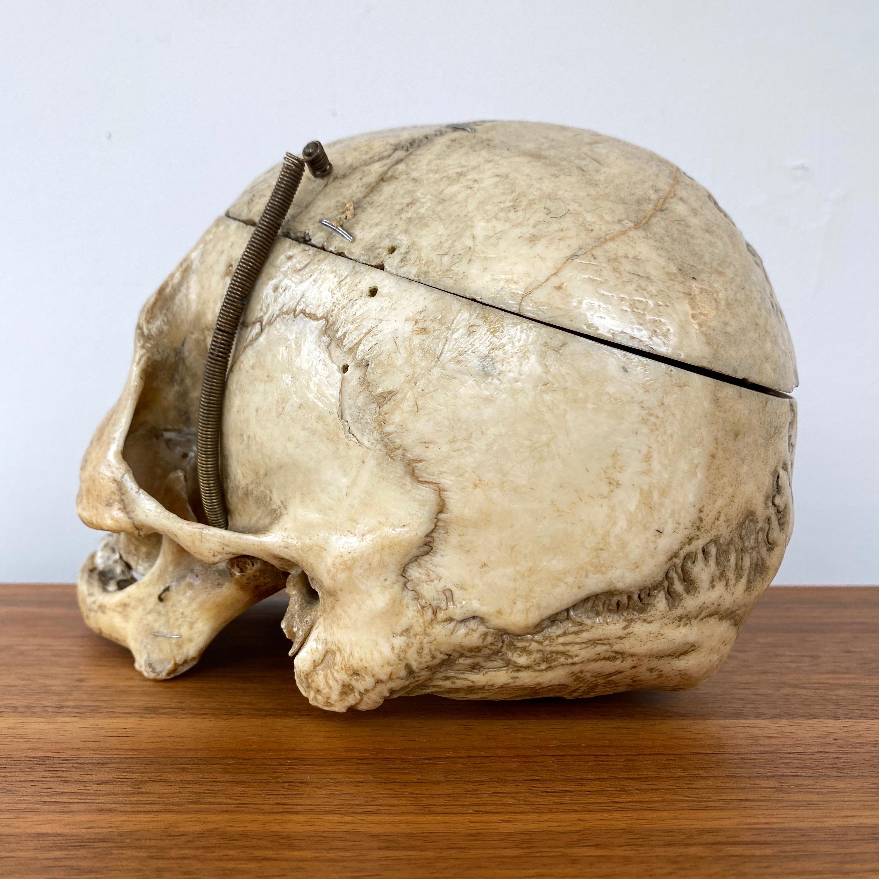 top of human skull