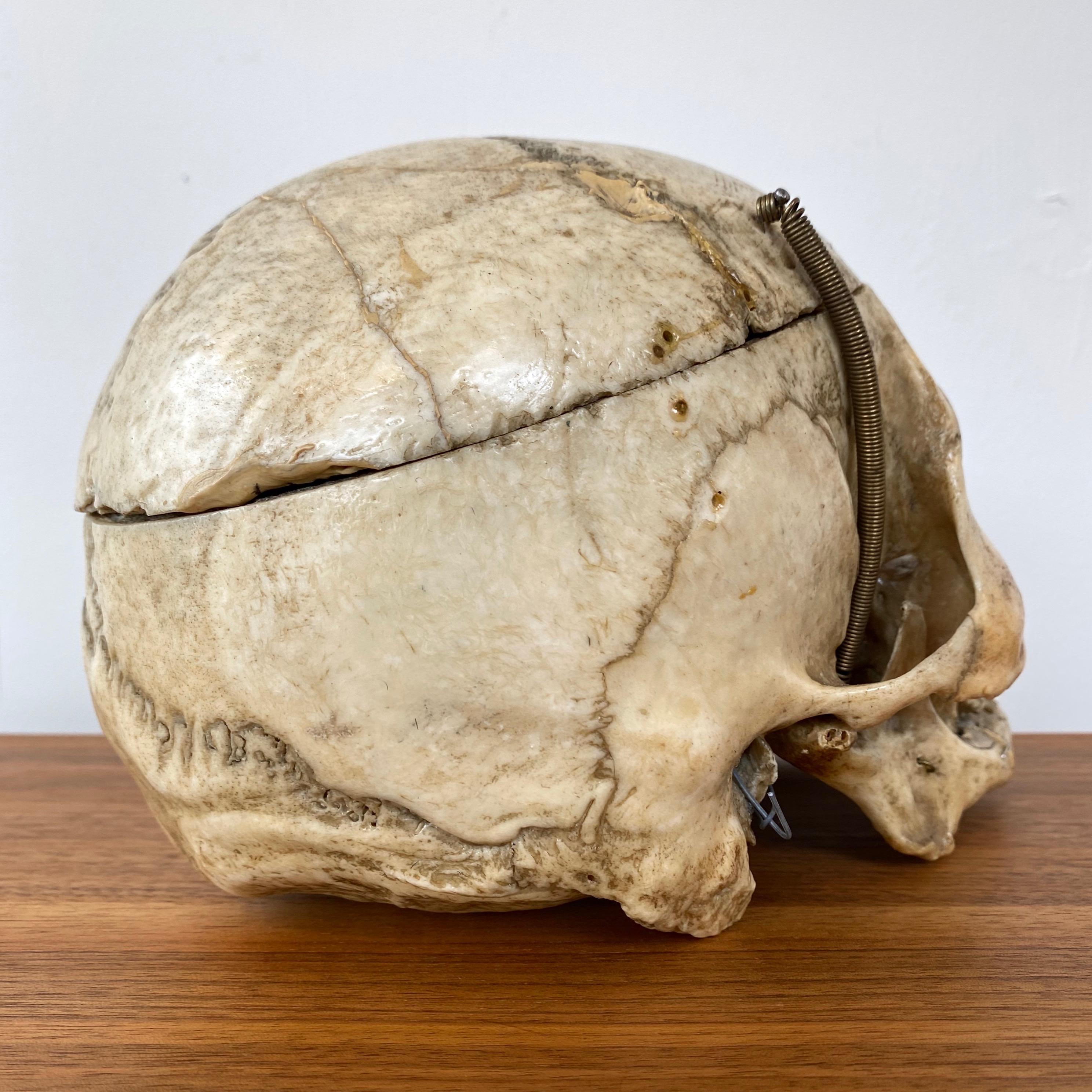 American Antique Articulated Human Skull, Medical Teaching Specimen, 1920