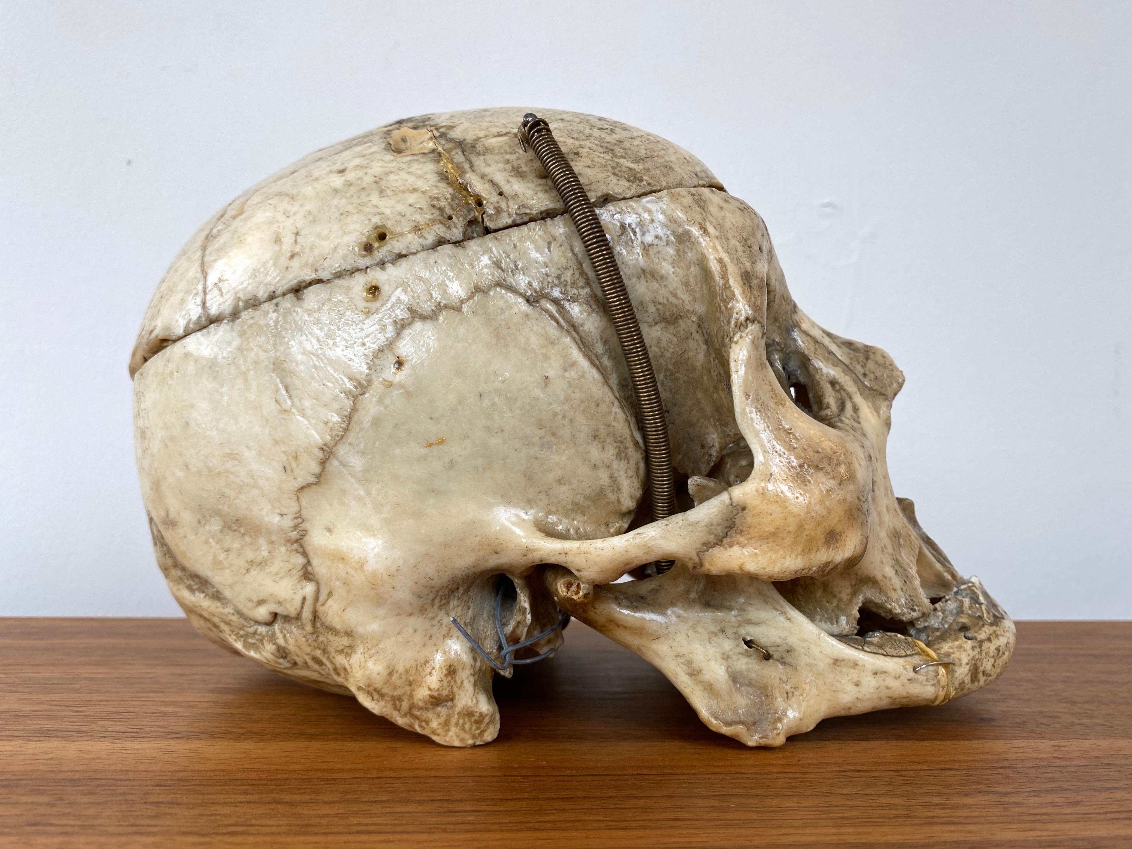 Antique Articulated Human Skull, Medical Teaching Specimen, 1920 In Good Condition In San Francisco, CA