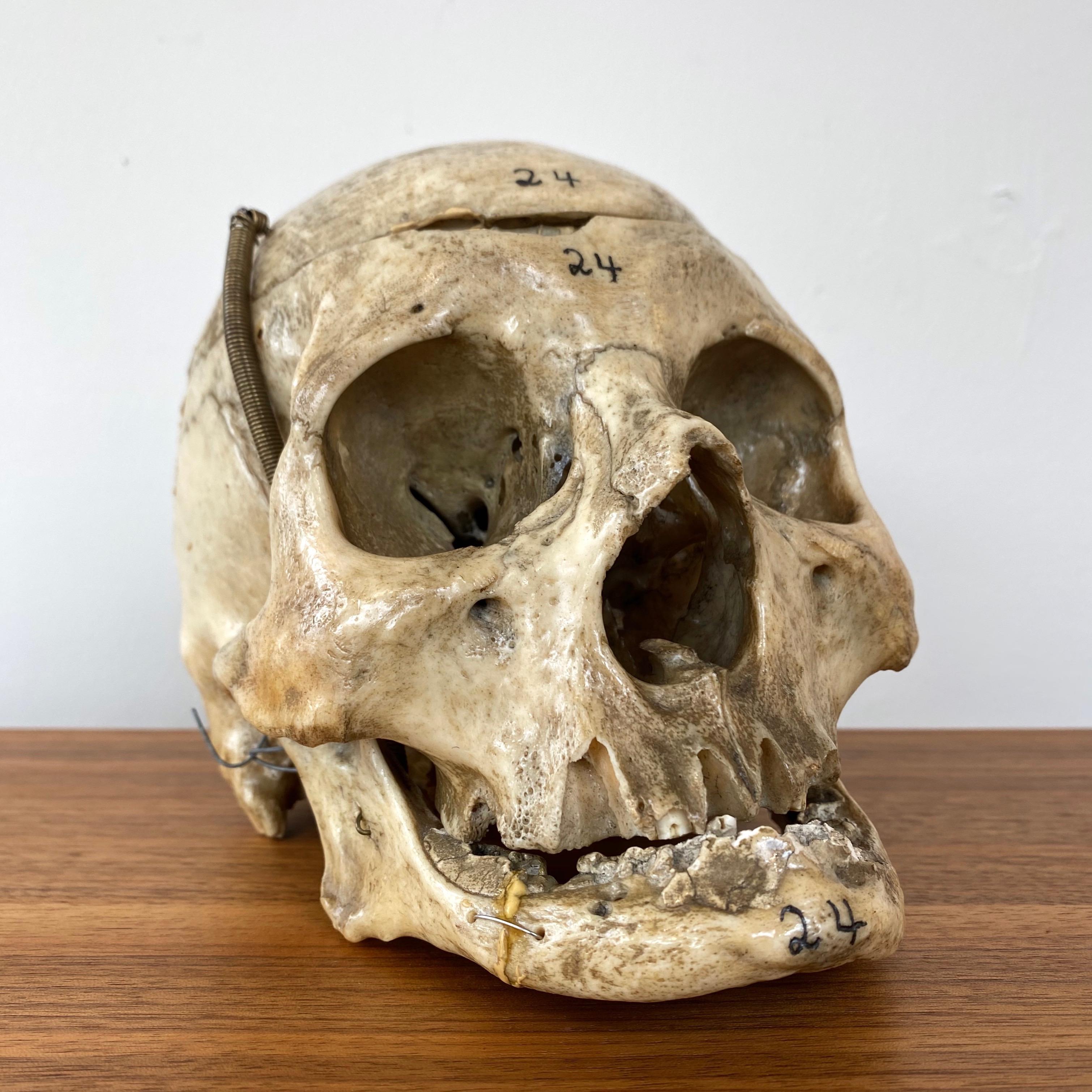 Early 20th Century Antique Articulated Human Skull, Medical Teaching Specimen, 1920