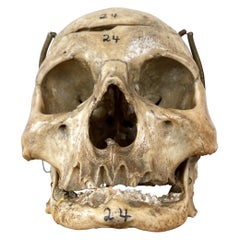 Used Articulated Human Skull, Medical Teaching Specimen, 1920