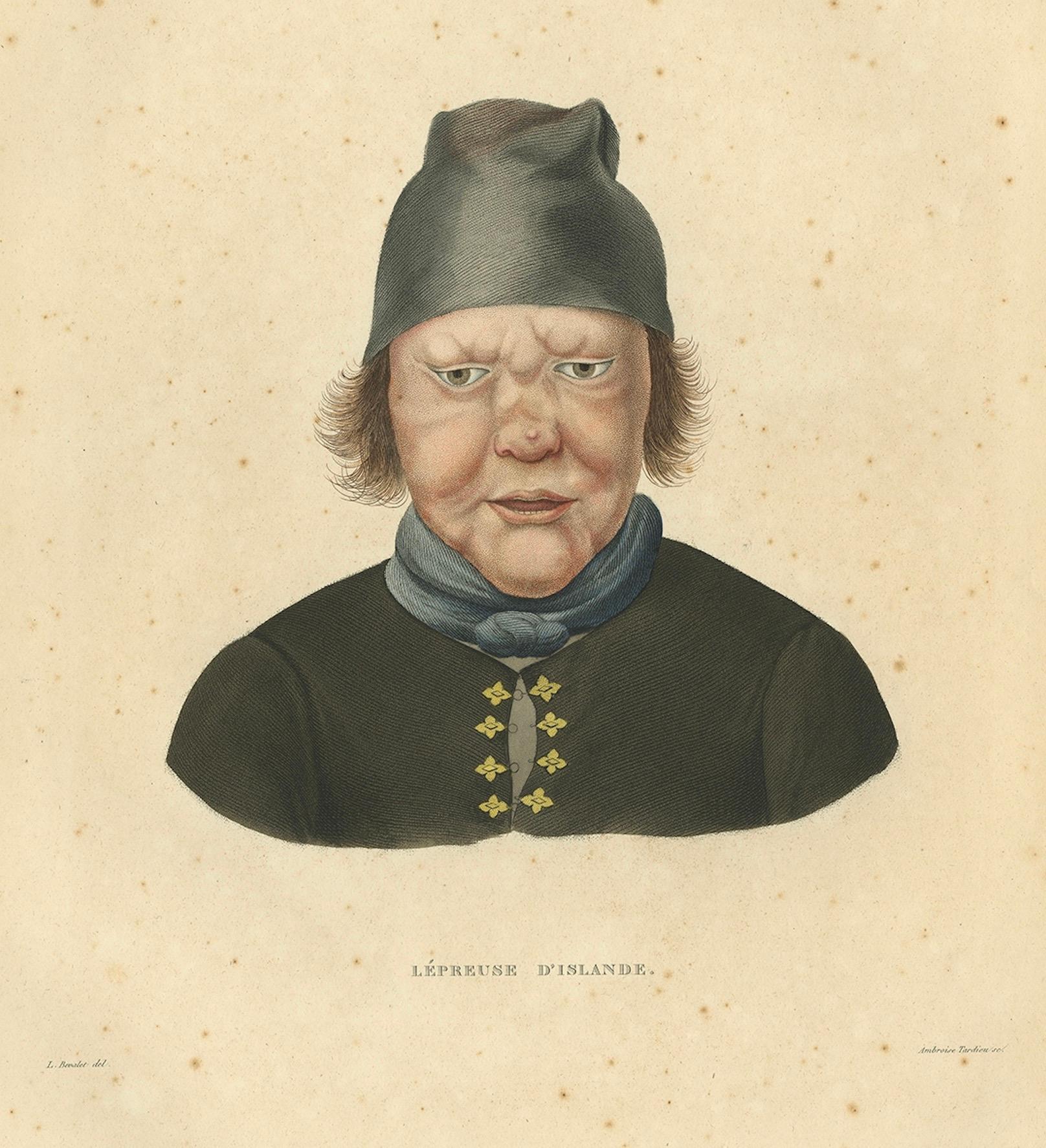 Antiker Druck eines Kranken aus Island - Gaimard-Reise, 1842

HINWEIS: Diese Lithographie wird ohne Rahmen oder Passepartout verkauft. 

Diese auffällige handkolorierte Lithografie mit dem Titel 