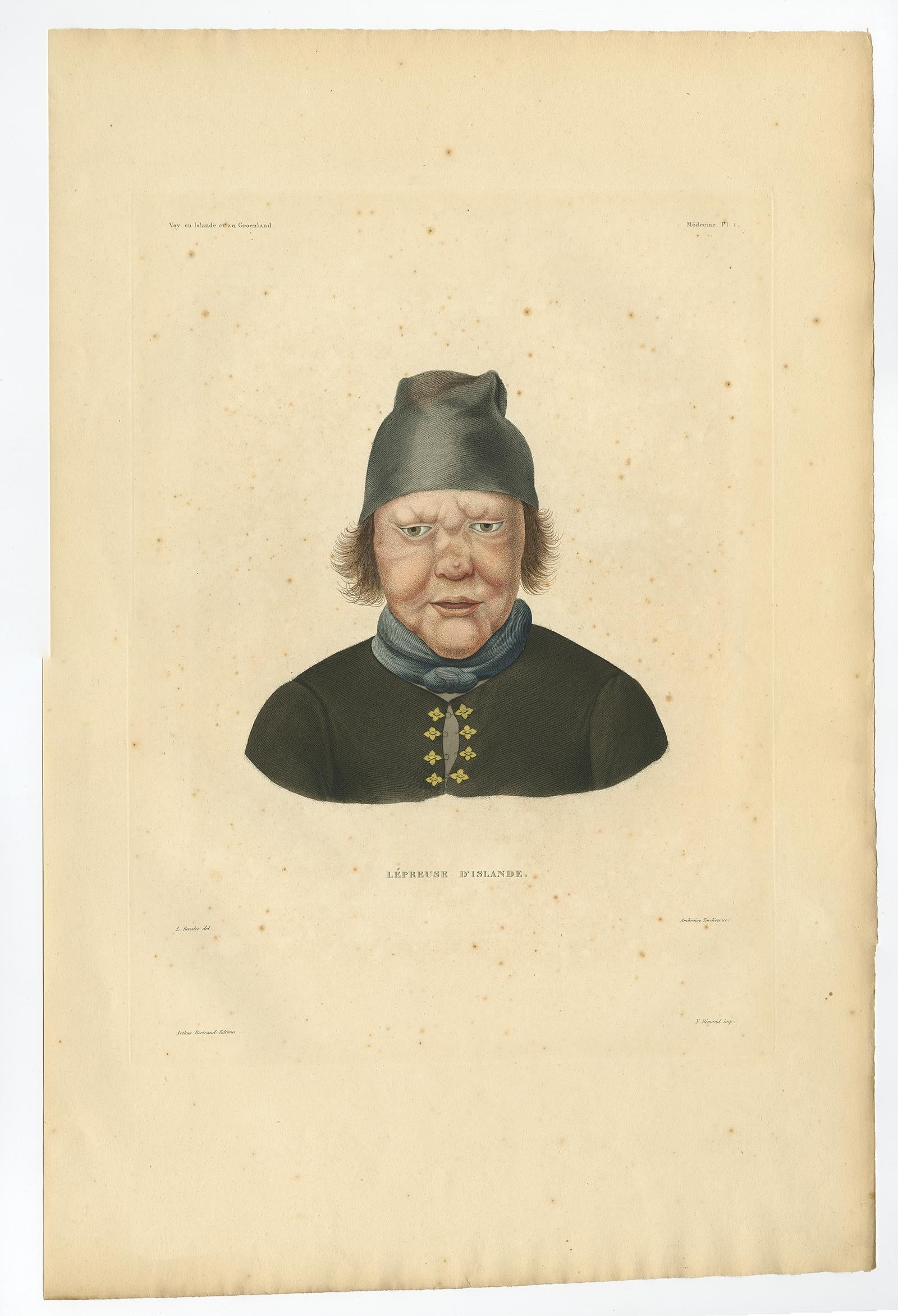 Antiker isländischer Druck - Figur eines Leprakranken aus Gaimards Reise, veröffentlicht 1842 im Zustand „Gut“ im Angebot in Langweer, NL