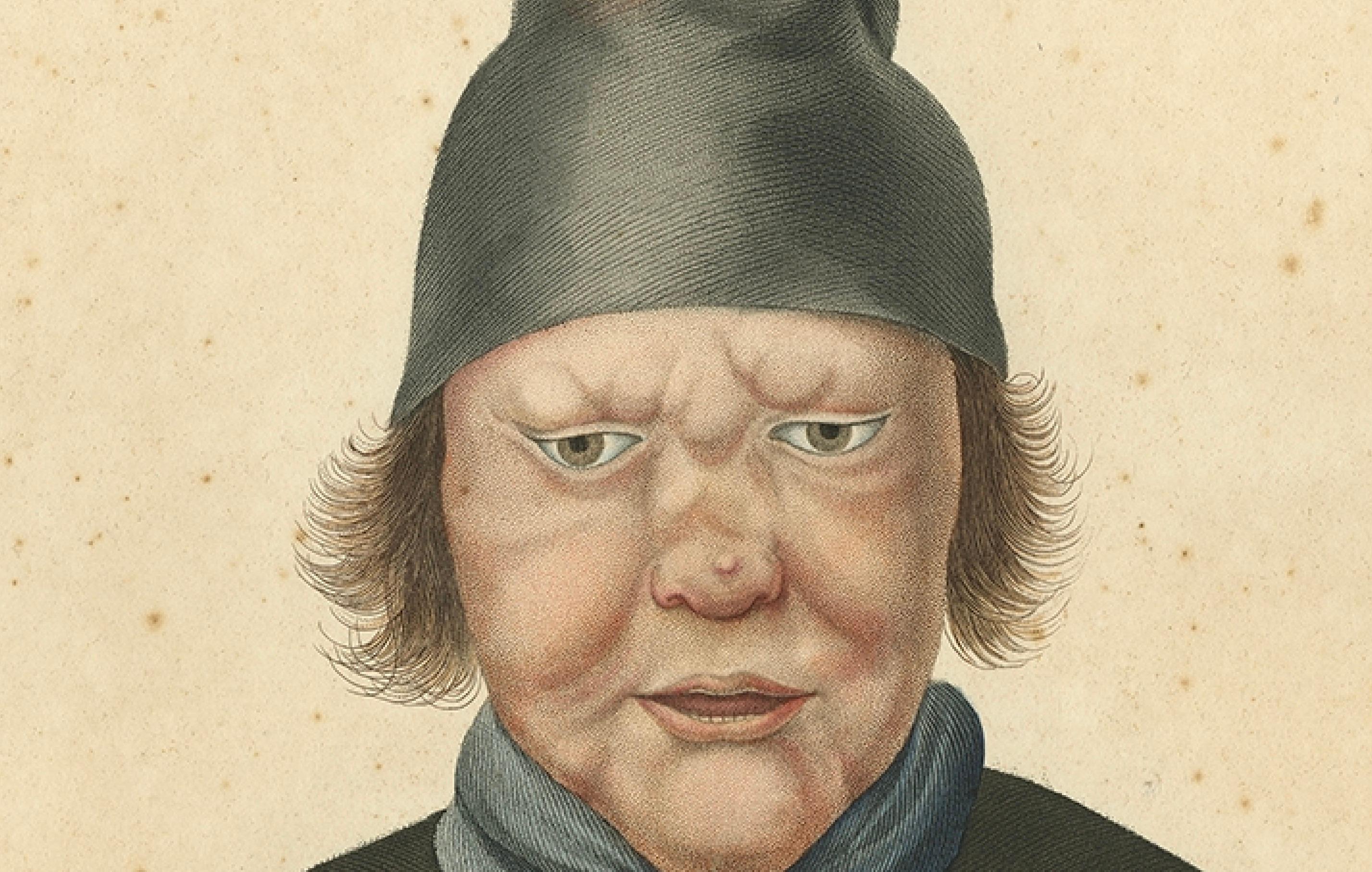 Antiker isländischer Druck - Figur eines Leprakranken aus Gaimards Reise, veröffentlicht 1842 (19. Jahrhundert) im Angebot