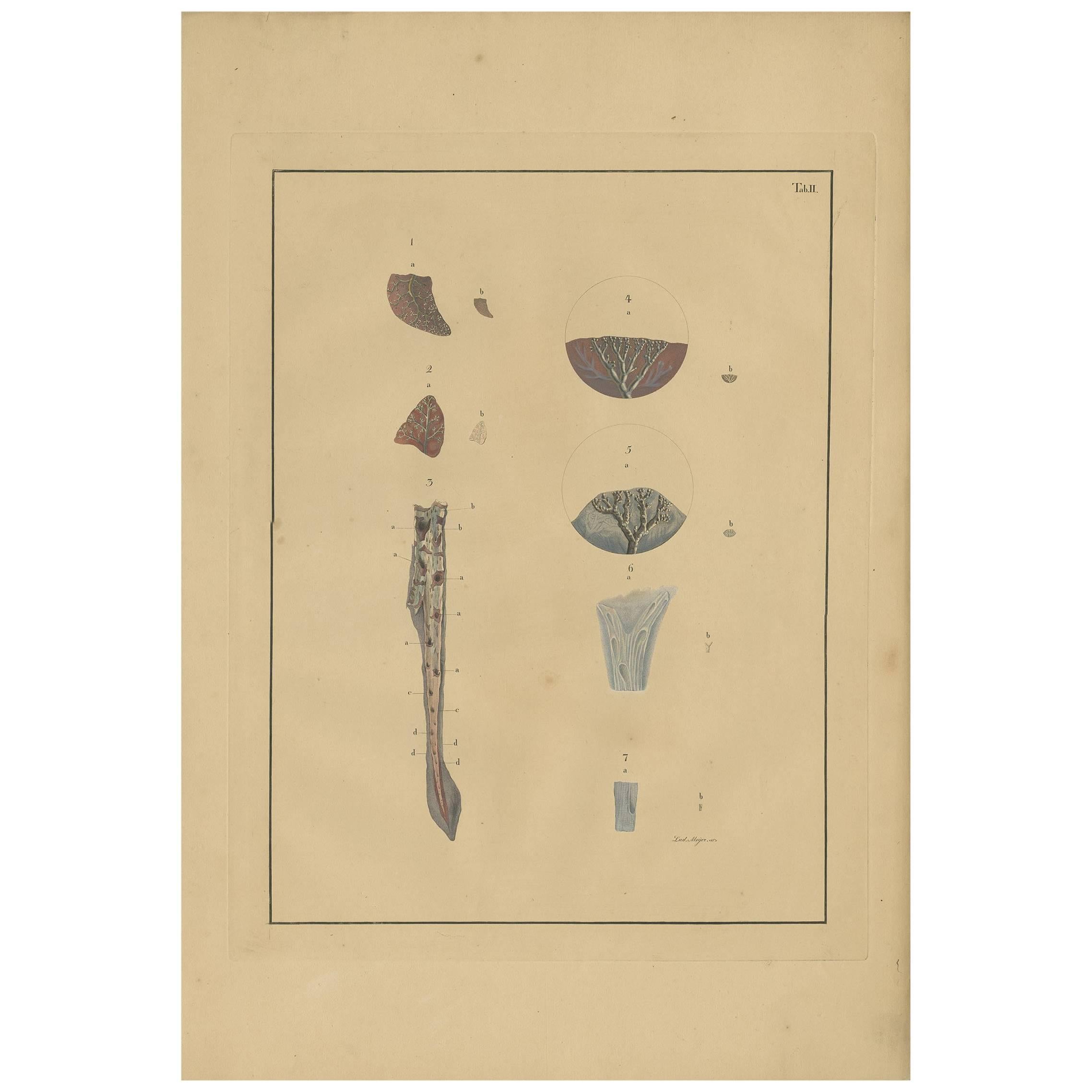 Antique Medical Print of Lungs 'Tab. 2' by F.D. Reisseisen, 1822