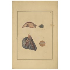 Impression médicale ancienne de Lungs 'Tab. 5' par F.D. Reisseisen, 1822