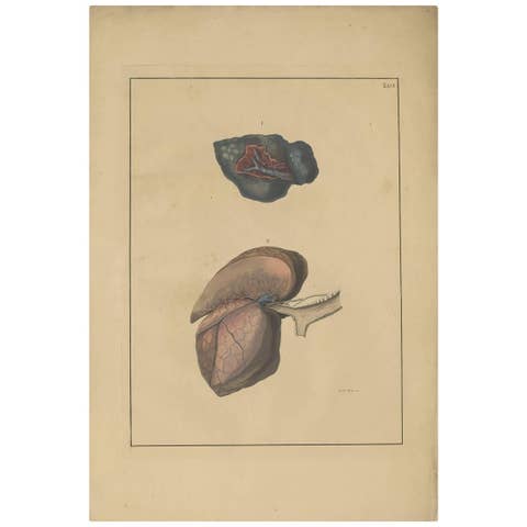 Antique Medical Print of Lungs ‘Tab. 6’ by F.D. Reisseisen, 1822
