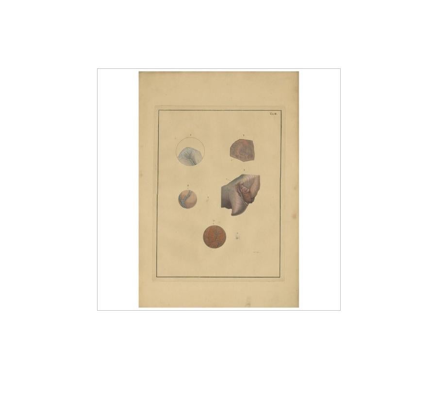 XIXe siècle Impression médicale ancienne de Lungs 'Tab.3' par F.D. Reisseisen, 1822 en vente