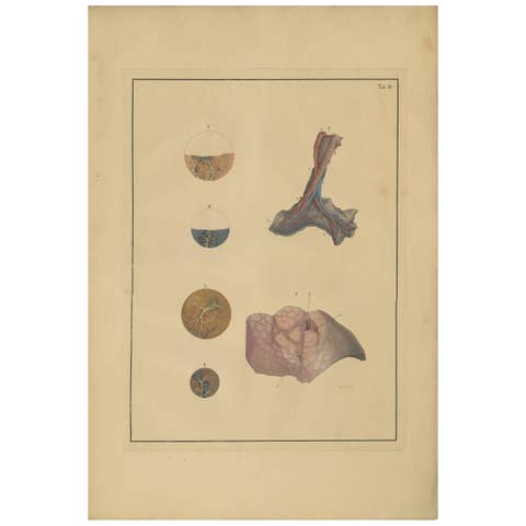 Antique Medical Print of Lungs 'Tab.4' by F.D. Reisseisen, 1822