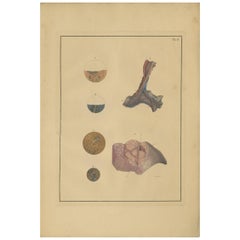 Antique Medical Print of Lungs 'Tab.4' by F.D. Reisseisen, 1822