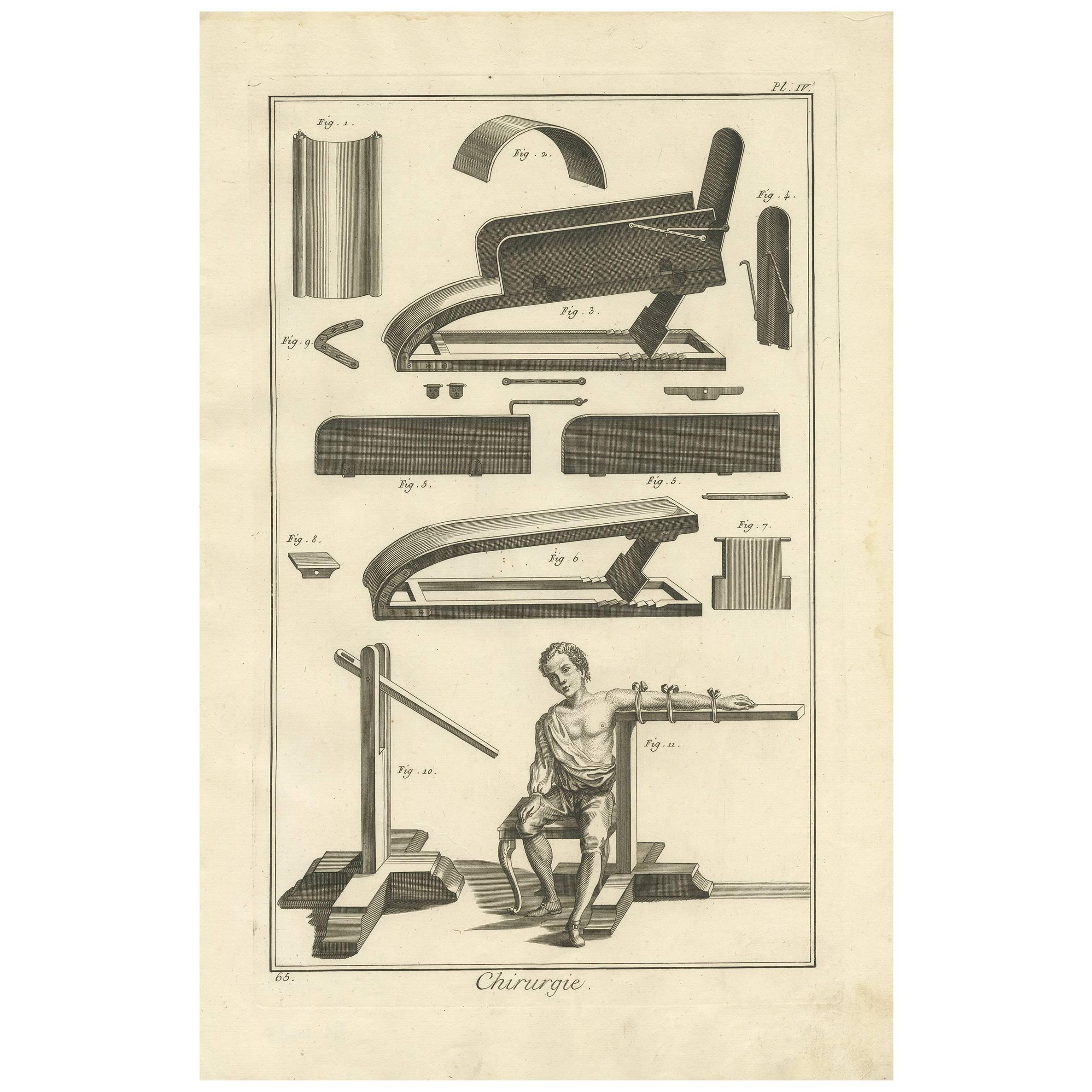 Antique Medical Print 'Pl. IV' by D. Diderot, circa 1760 For Sale