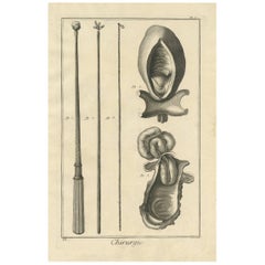Antique Medical Print 'Pl. V' by D. Diderot, circa 1760