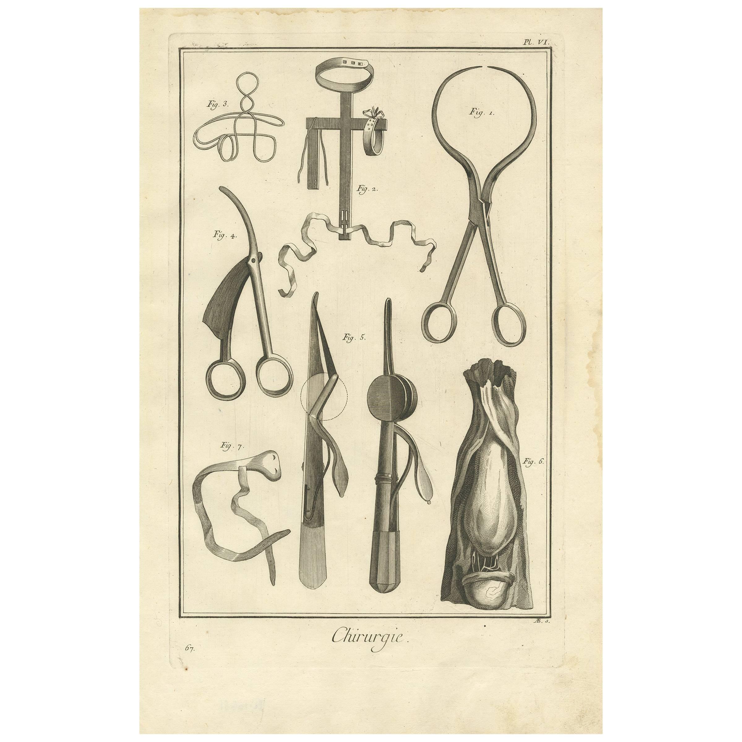 Antique Medical Print 'Pl. VI' by D. Diderot, circa 1760 For Sale