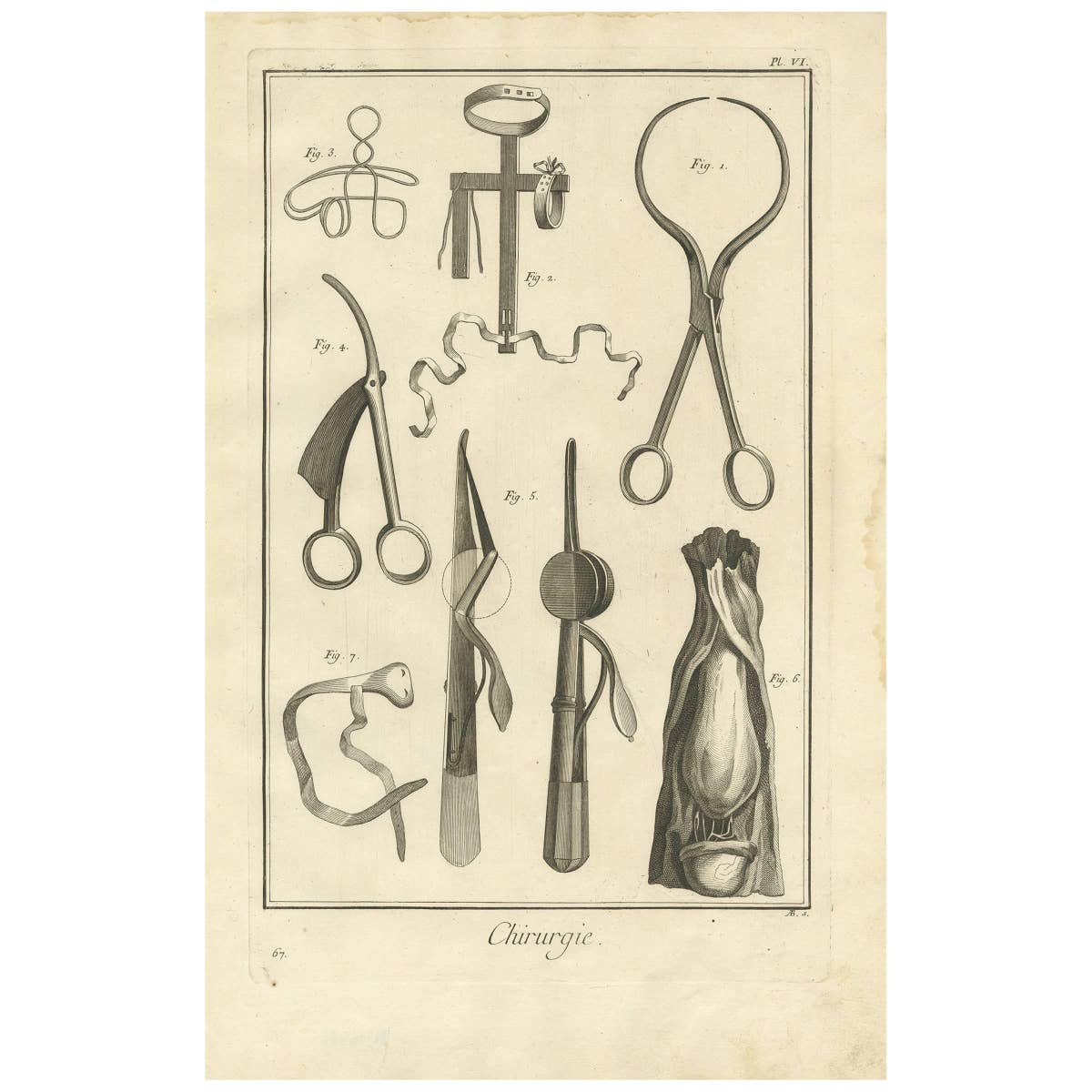 Antique Medical Print 'Pl. VI' by D. Diderot, circa 1760