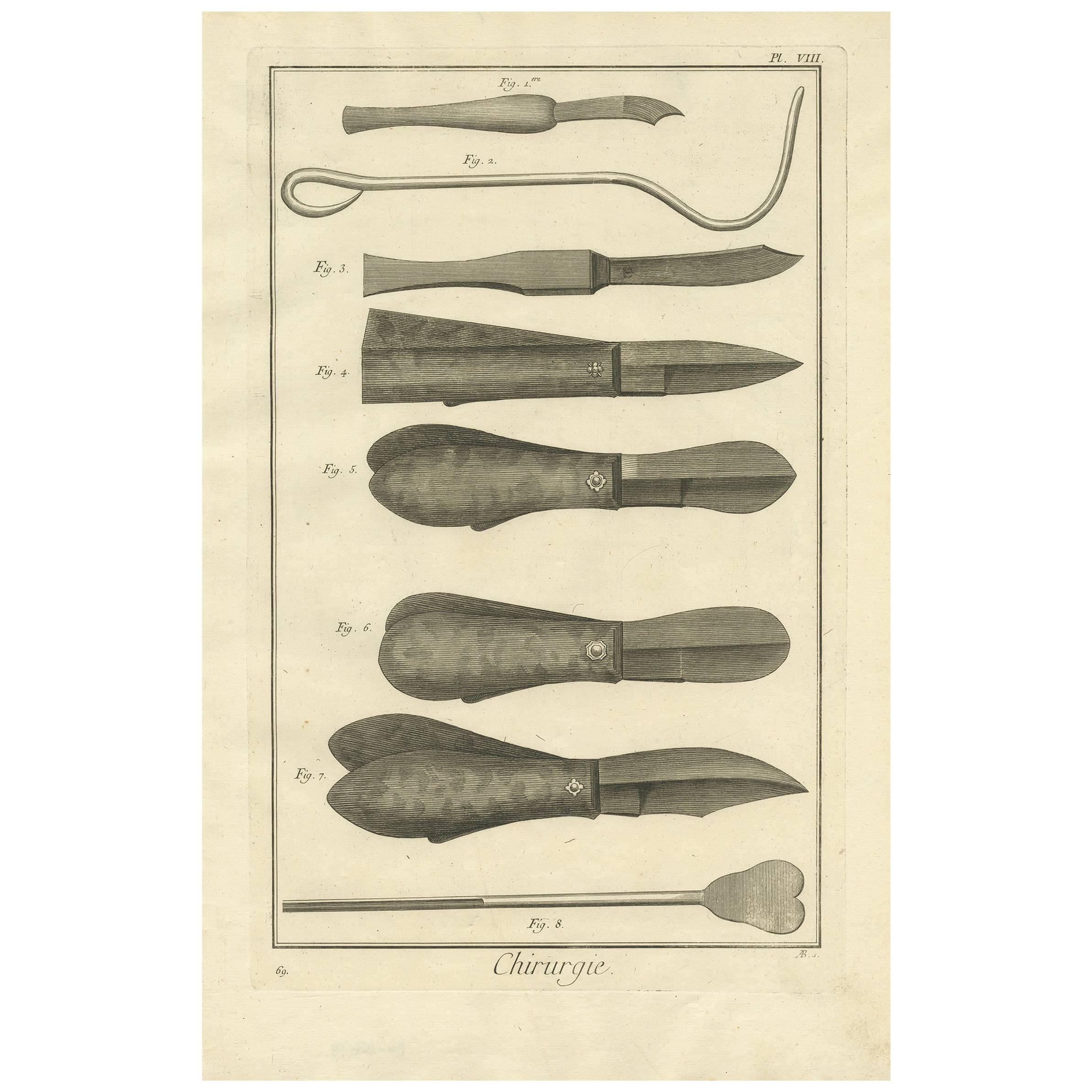 Antique Medical Print of Surgical Stones to Remove Stones, circa 1760
