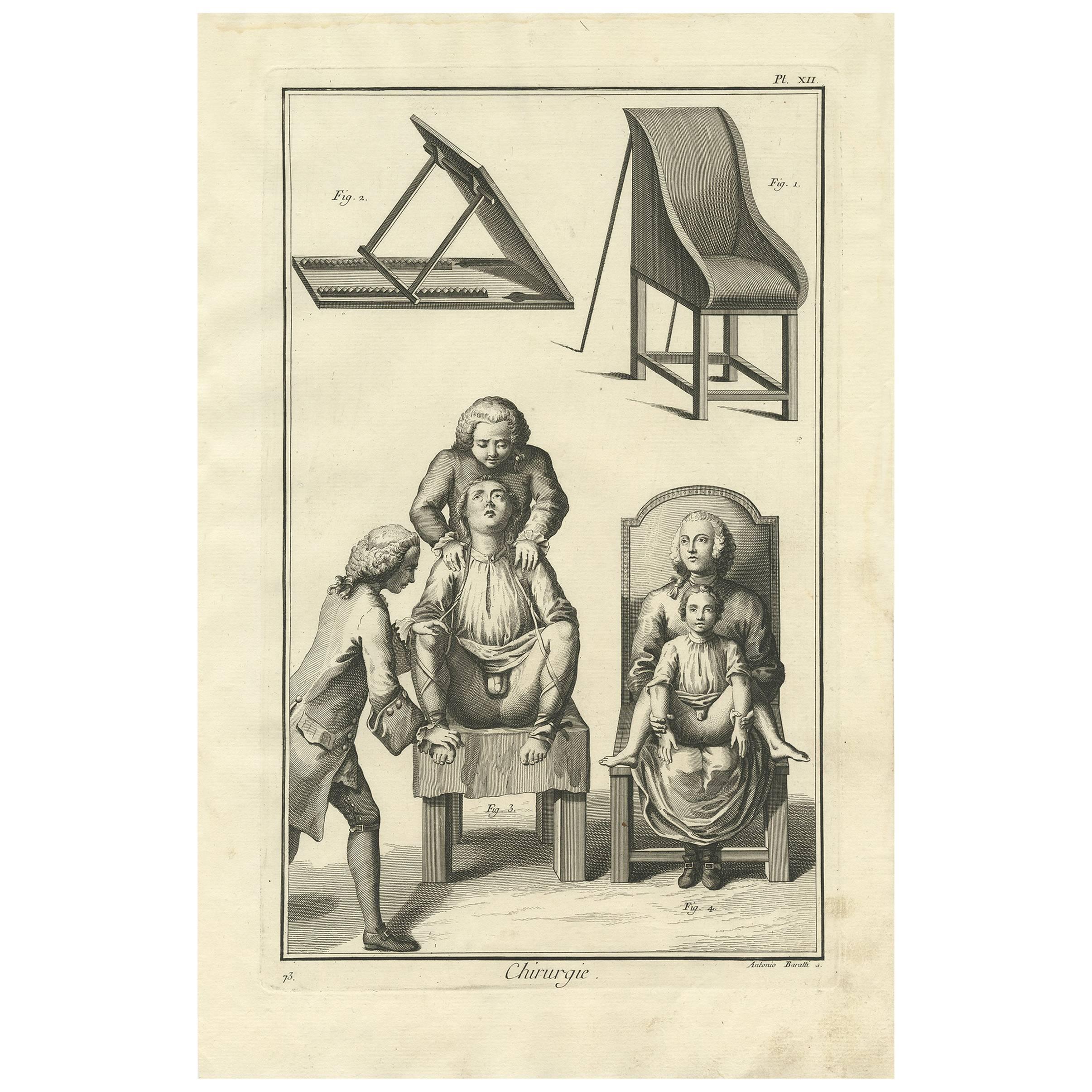Stampa medica antica 'Pl. XII" di D. A. Diderot, 1760 ca. in vendita