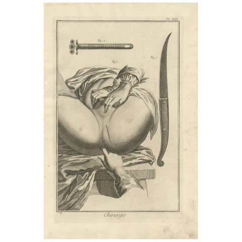 Antique Print of Surgery – Scalpel, Cannula & Perineum, Diderot, c.1760