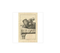 Antique Medical Print of a Lateral Section of the Hypogastrium, Abdomen, ca.1760