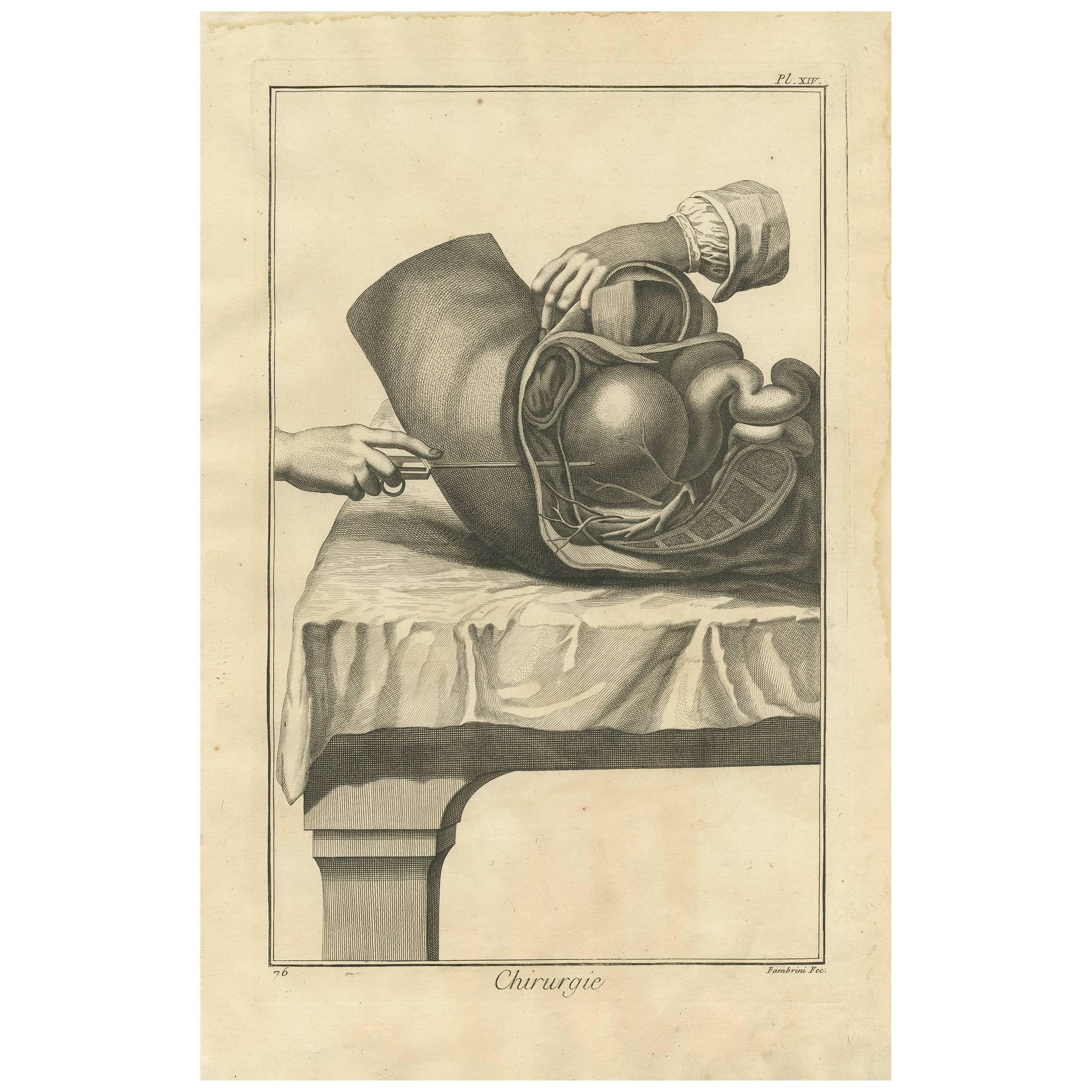 Antique Medical Print of a Lateral Section of the Hypogastrium, Abdomen, ca.1760 For Sale