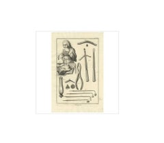 Antique Medical Print 'Pl. XVII' by D. Diderot, circa 1760
