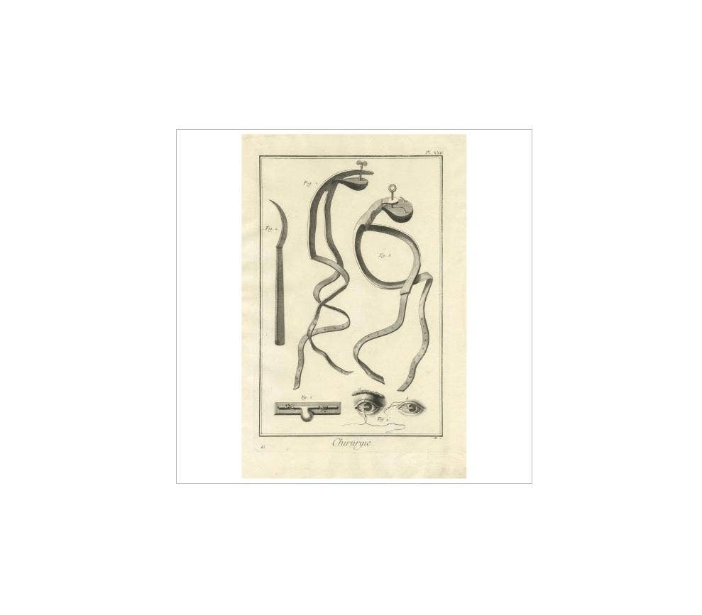 Antique Medical Print ‘Pl. XXII’ by D. Diderot, circa 1760