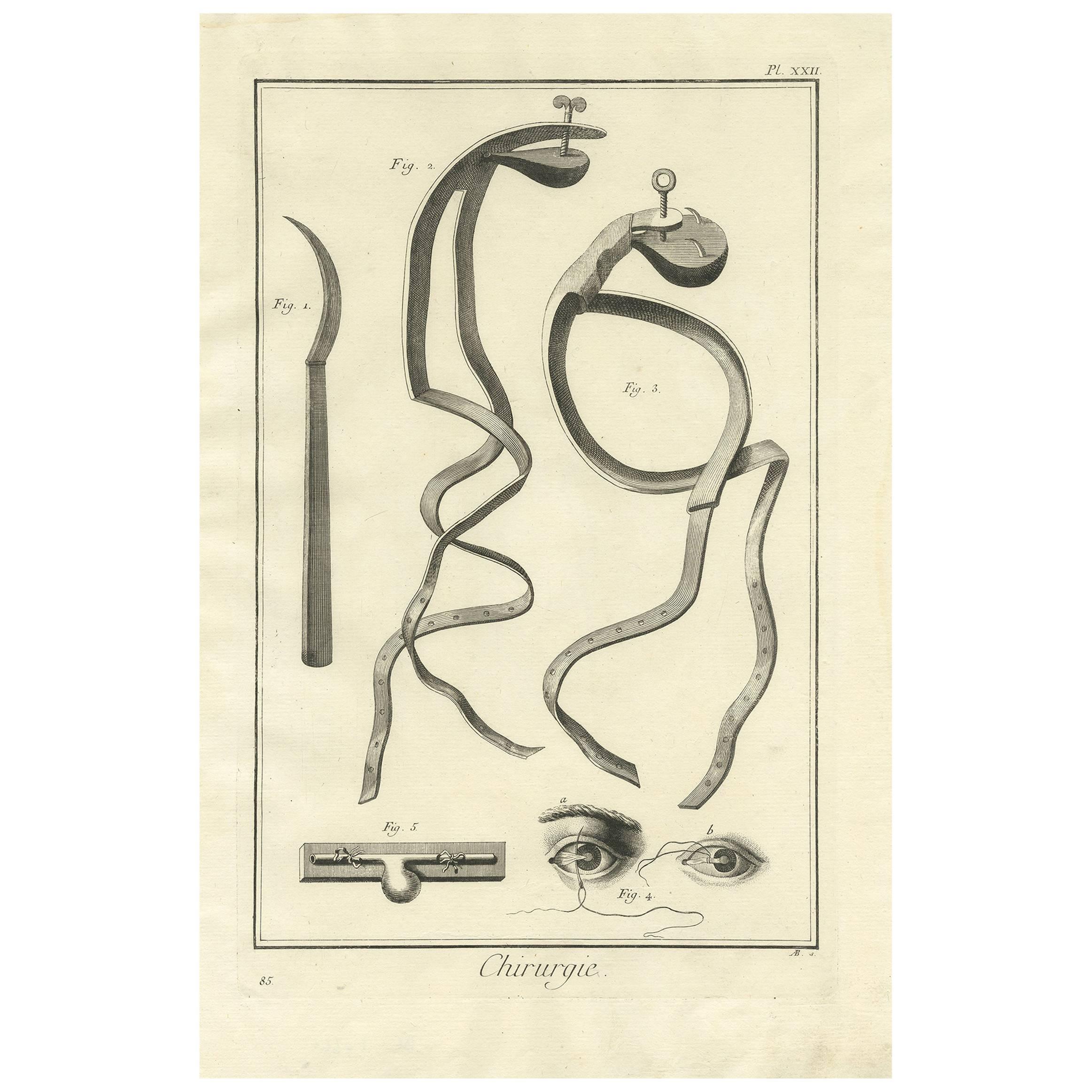 Estampe médicale ancienne 'Pl. XXII" par D. Diderot, vers 1760