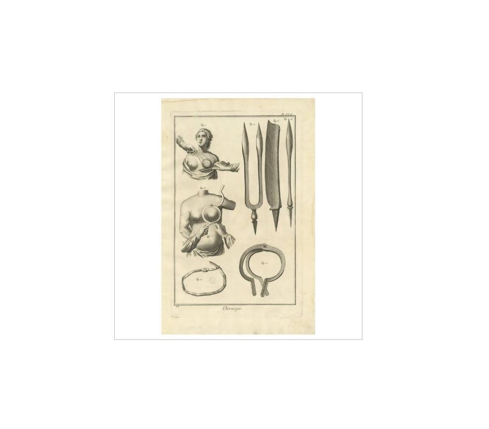 Plate XXIX: 'Chirurgie'. (Surgery.) This plate deals with the instruments used for amputation of a breast in the case of breast cancer. This print originates from 'Encyclopédie (..)' by D. Diderot. Published circa 1760.
