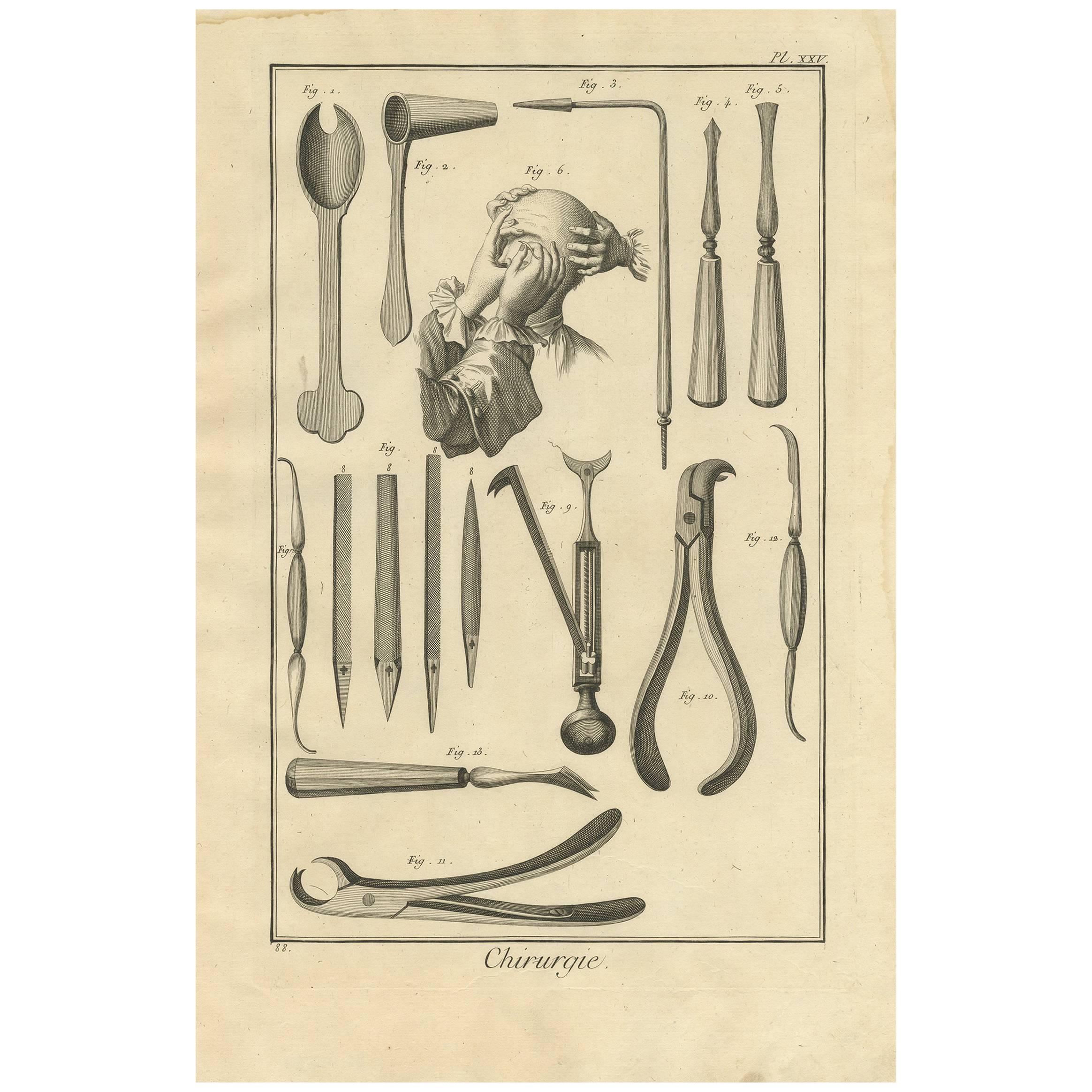 Antique Medical Print 'Pl. XXV' by D. Diderot, circa 1760 For Sale