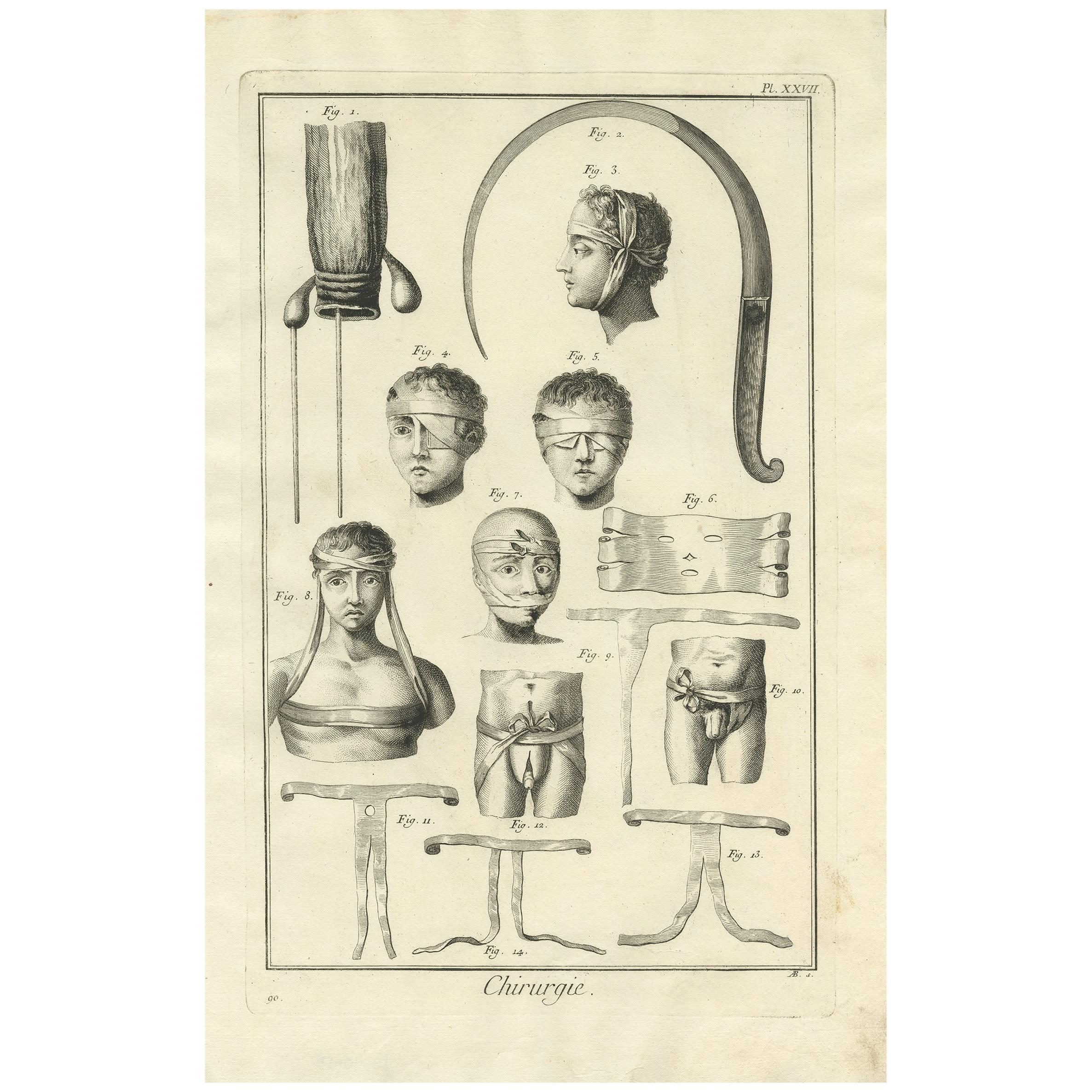Antique Medical Print 'Pl. XXVII' by D. Diderot, circa 1760