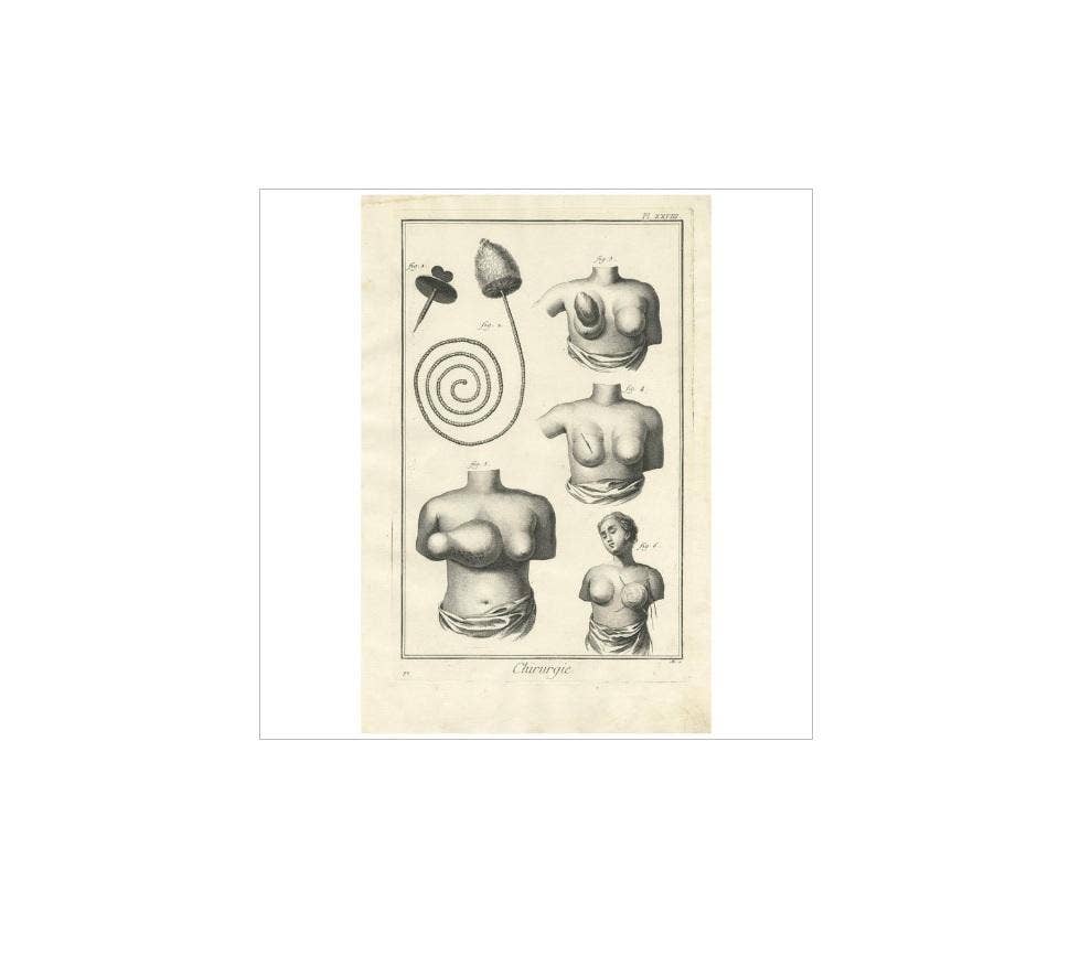 Antique Medical Print 'Pl. XXVIII' by D. Diderot, circa 1760