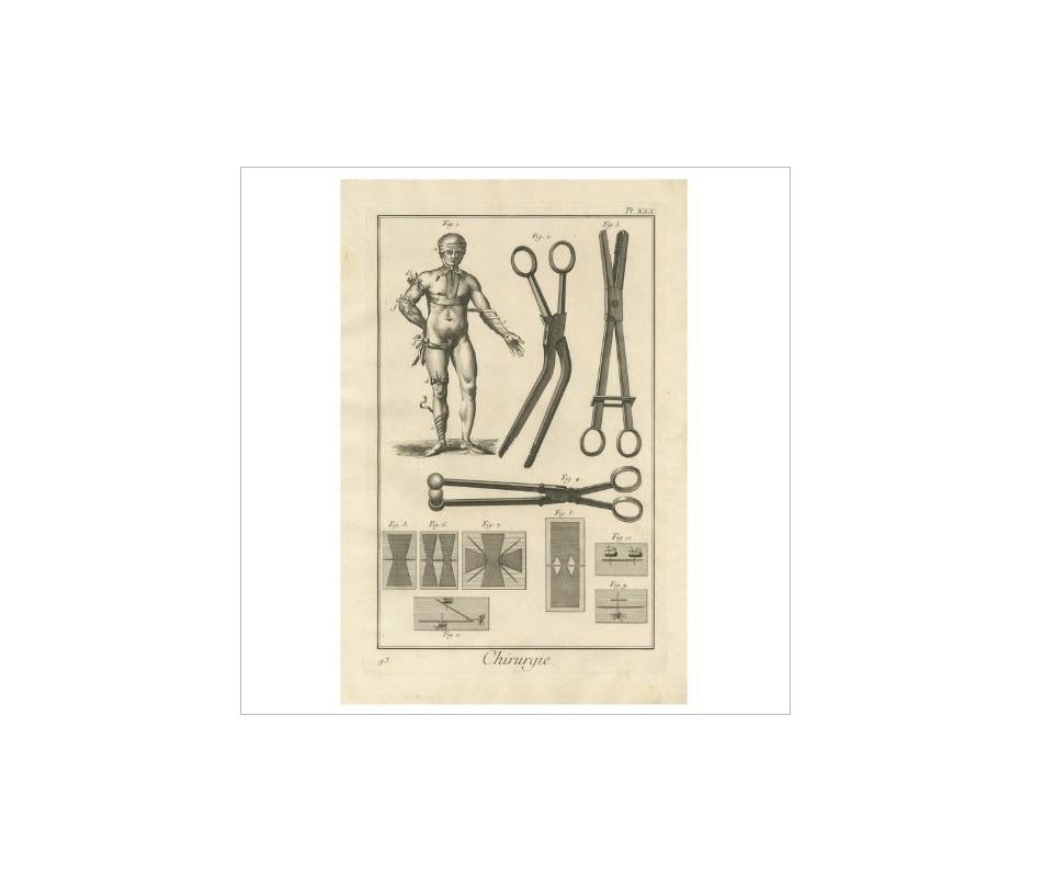 Plate XXX: 'Chirurgie'. (Surgery.) This plate deals with bandages and instruments used for applying bandages. This print originates from 'Encyclopédie (..)' by D. Diderot. Published, circa 1760.