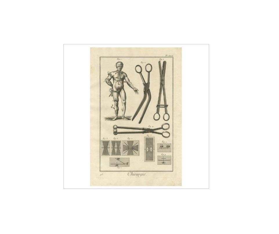 Antique Medical Print 'Pl. XXX' by D. Diderot, circa 1760