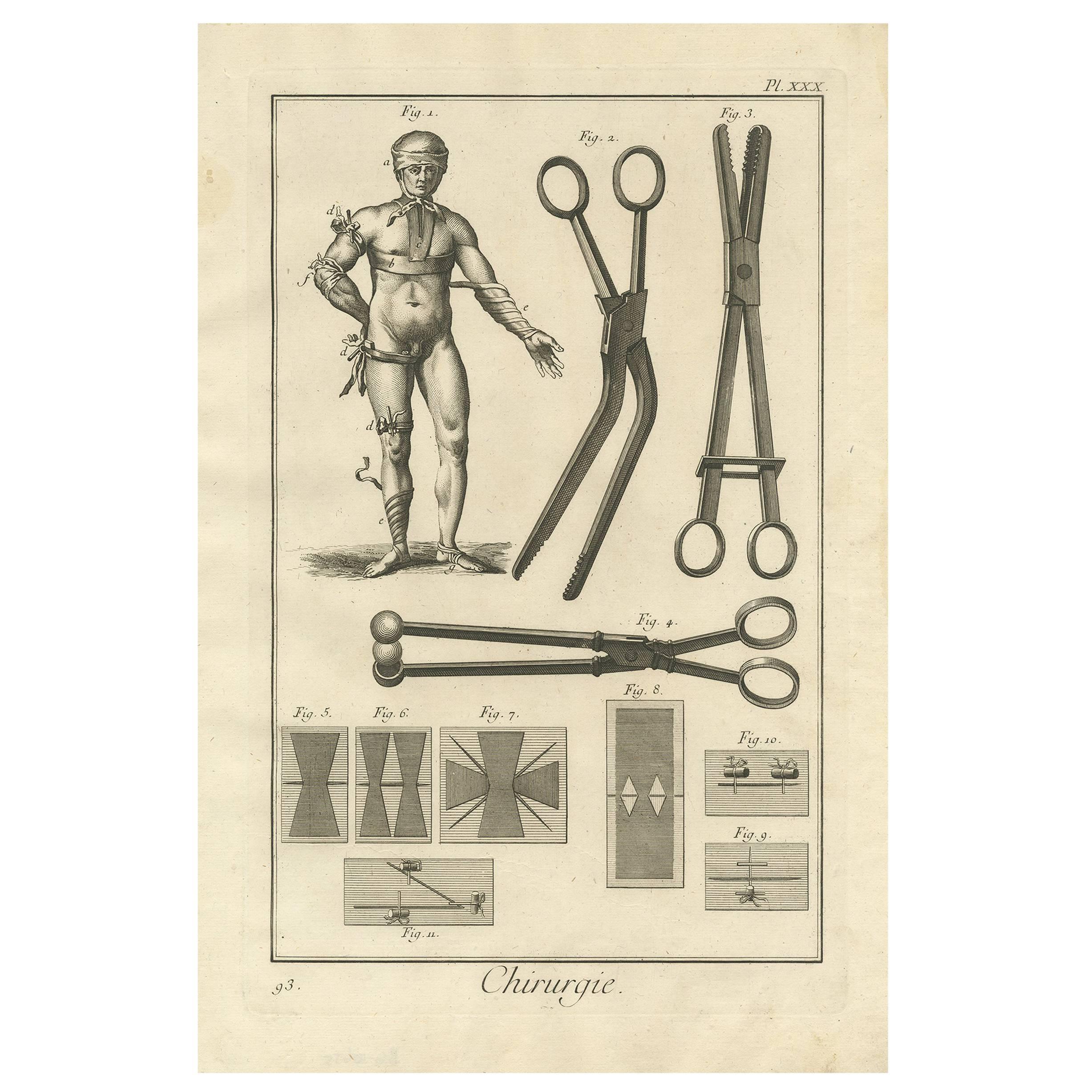 Impression médicale ancienne d'antiquités XXX » de D. Diderot, vers 1760 en vente