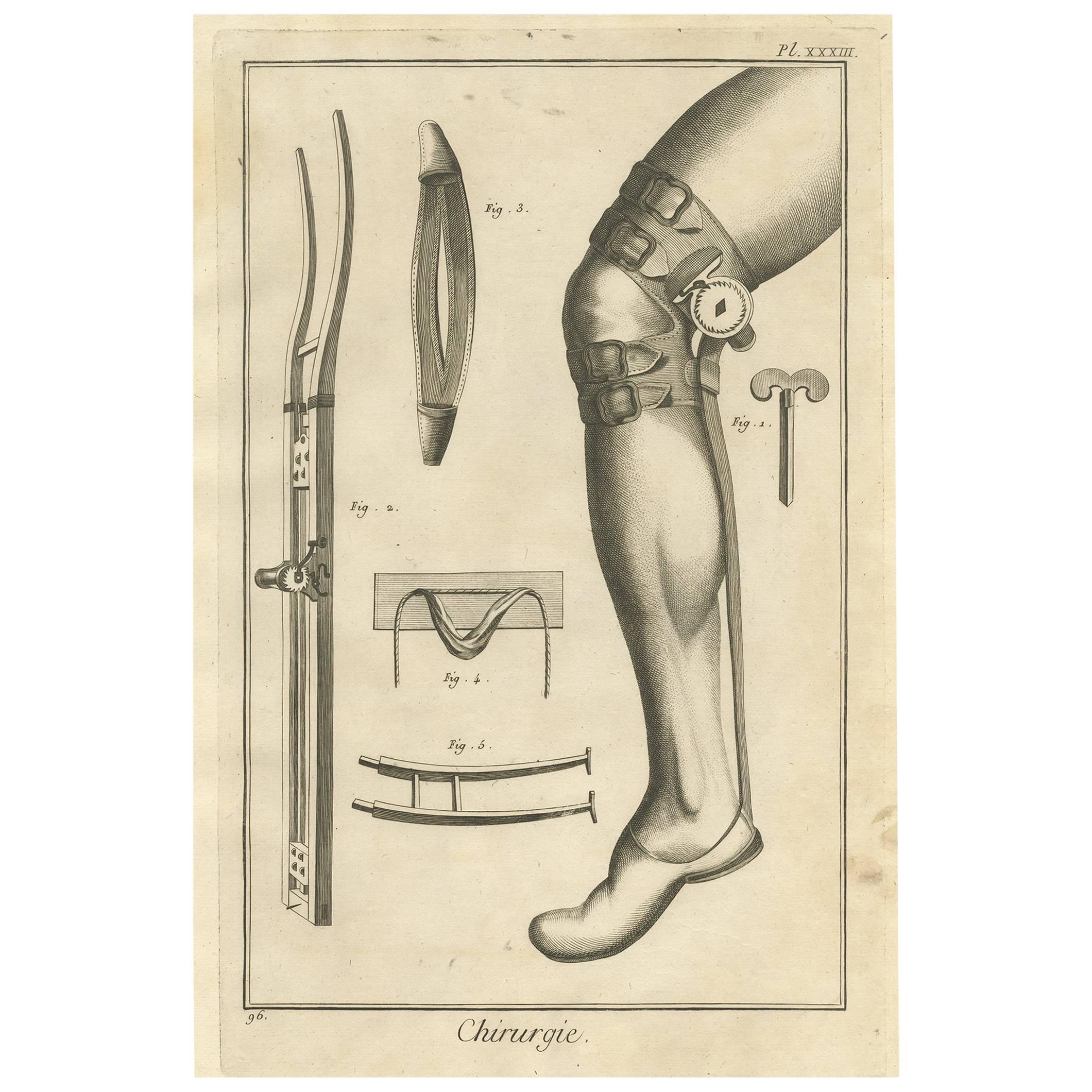 Antique Medical Print ‘Pl. XXXIII’ by D. Diderot, circa 1760 For Sale