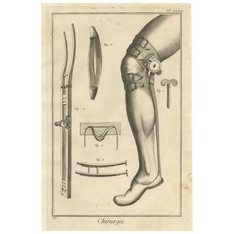 Antique Medical Engraving ‘Chirurgie, Achilles Tendon Devices’, 1760