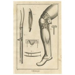 Antiker medizinischer Druck 'Pl. XXXIII“ von D. Diderot, um 1760