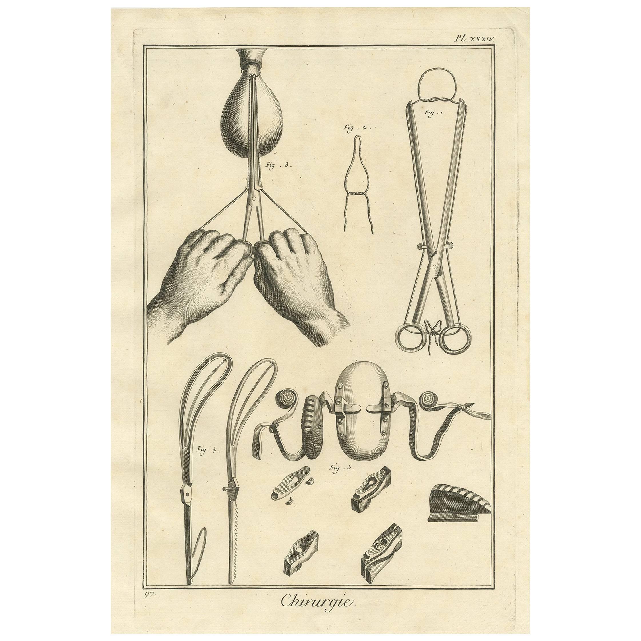 Antique Medical Print 'Pl. XXXIV' by D. Diderot, circa 1760 For Sale