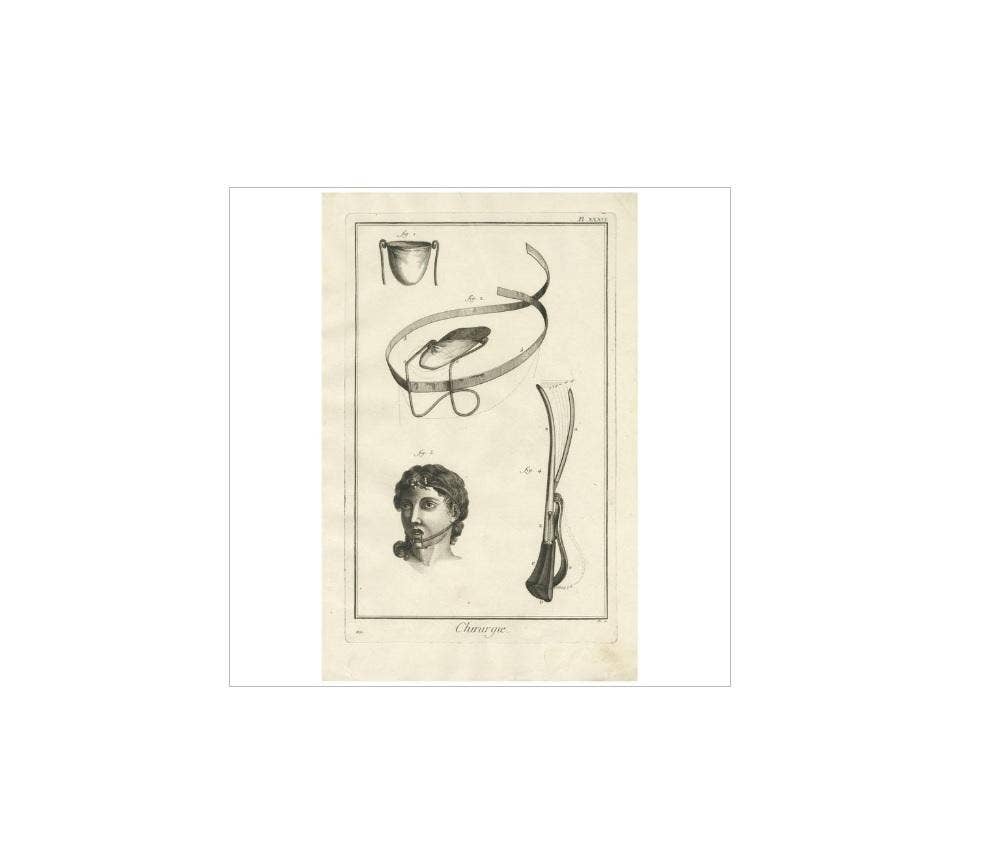 Antique Medical Print 'Pl. XXXVI' by D. Diderot, circa 1760