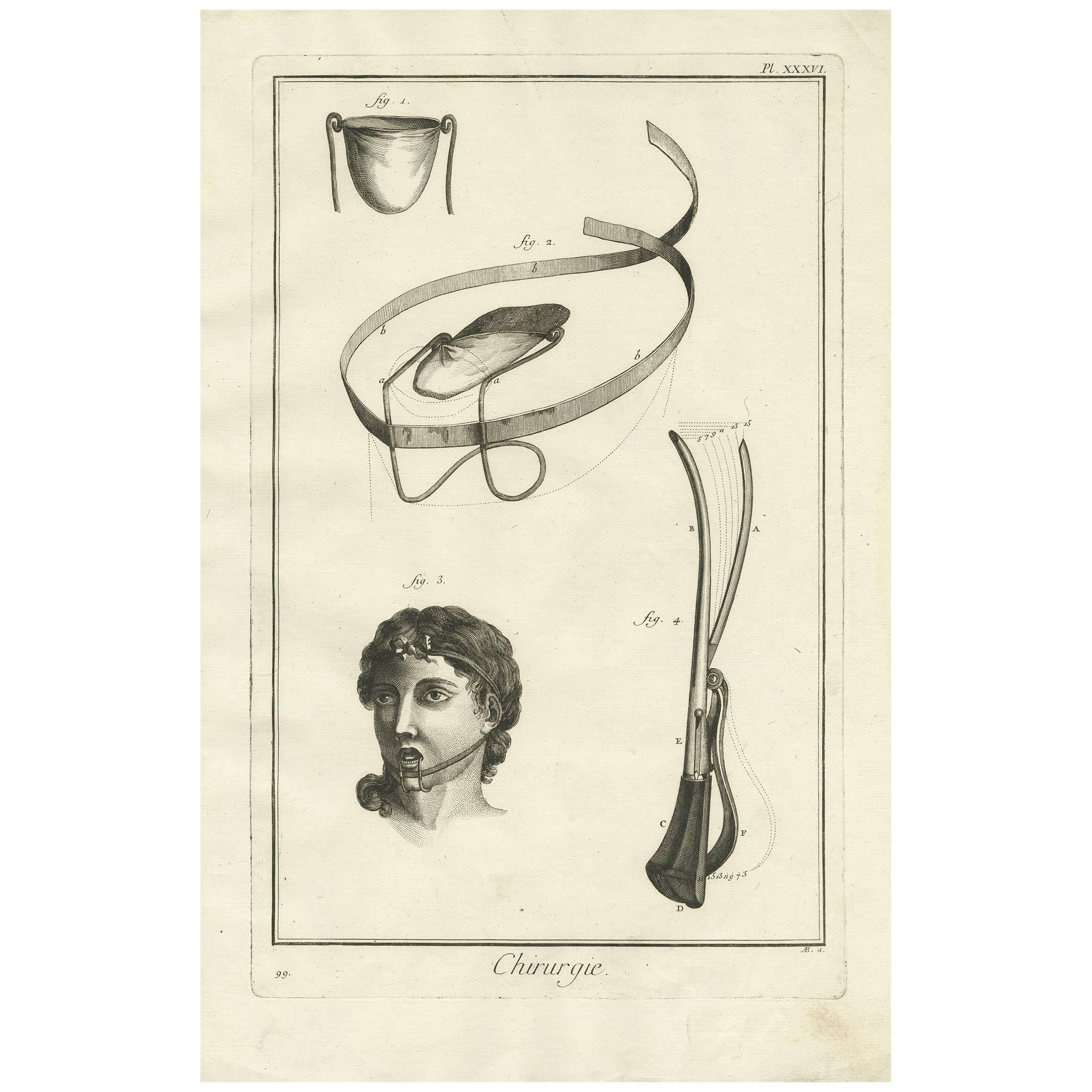 Antique Medical Print 'Pl. XXXVI' by D. Diderot, circa 1760 For Sale