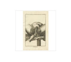 Antique Medical Print 'Seconde Pl. XIII' by D. Diderot, circa 1760