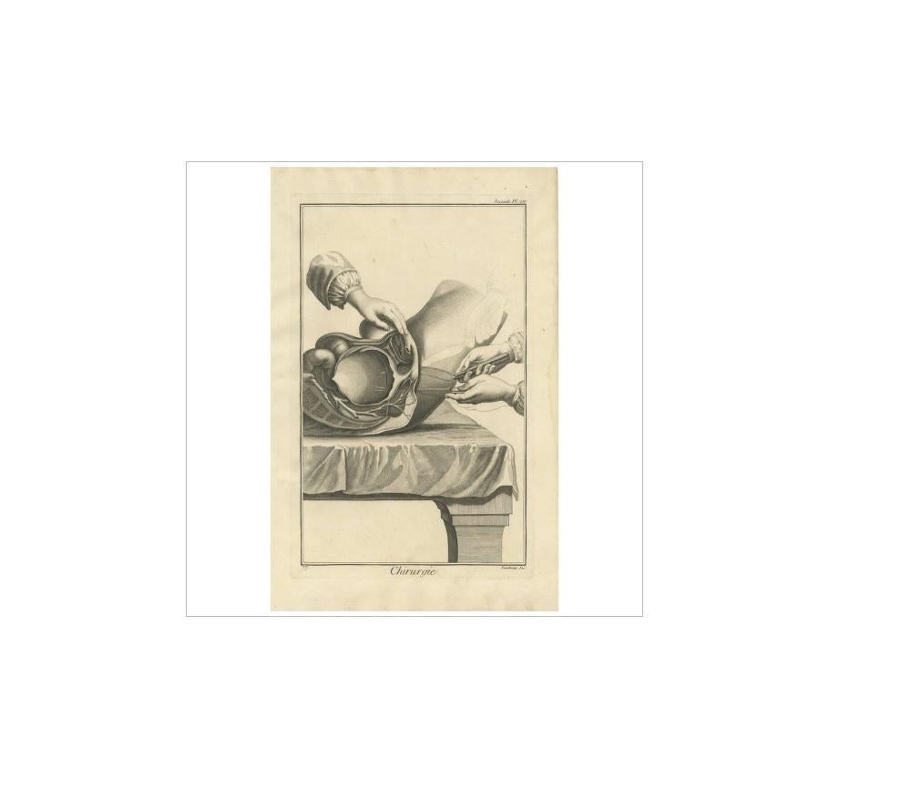 18th Century Antique Medical Print 'Seconde Pl. XIV' by D. Diderot, circa 1760 For Sale