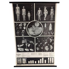Tableau mural antique sur la glande pituitaire
