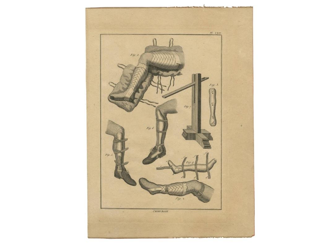 XVIII secolo Stampa antica di Tecniche di chirurgia delle gambe di H. Agasse, 1798 circa in vendita