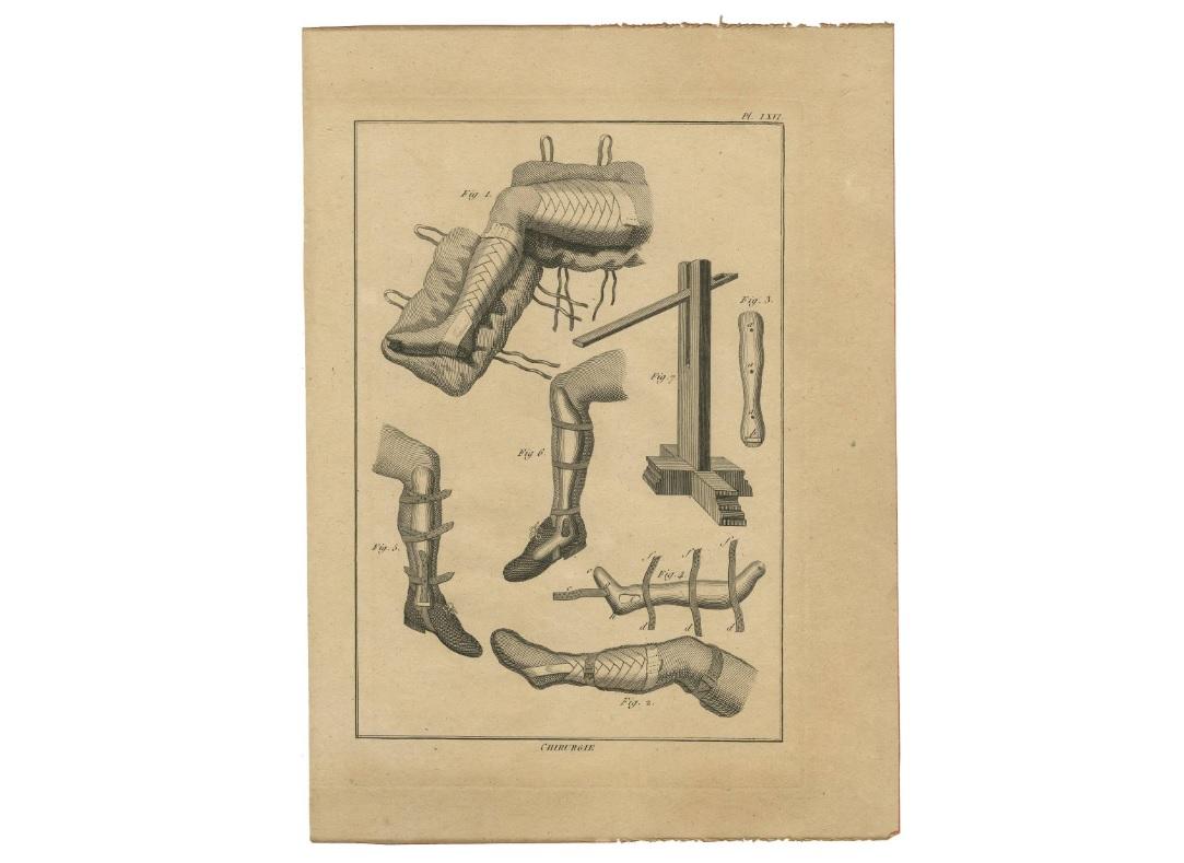 Antiker Druck von Leg Surgery Techniques von H. Agasse, um 1798 (18. Jahrhundert) im Angebot