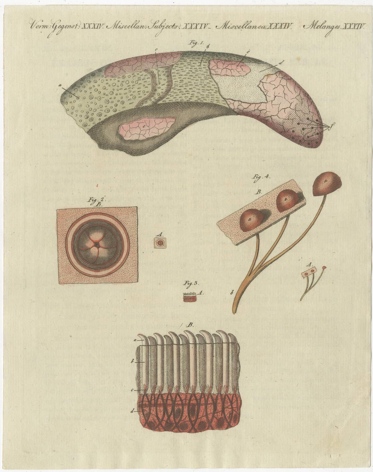 Antique Print of the Examination of a Beef Tongue of a Cow